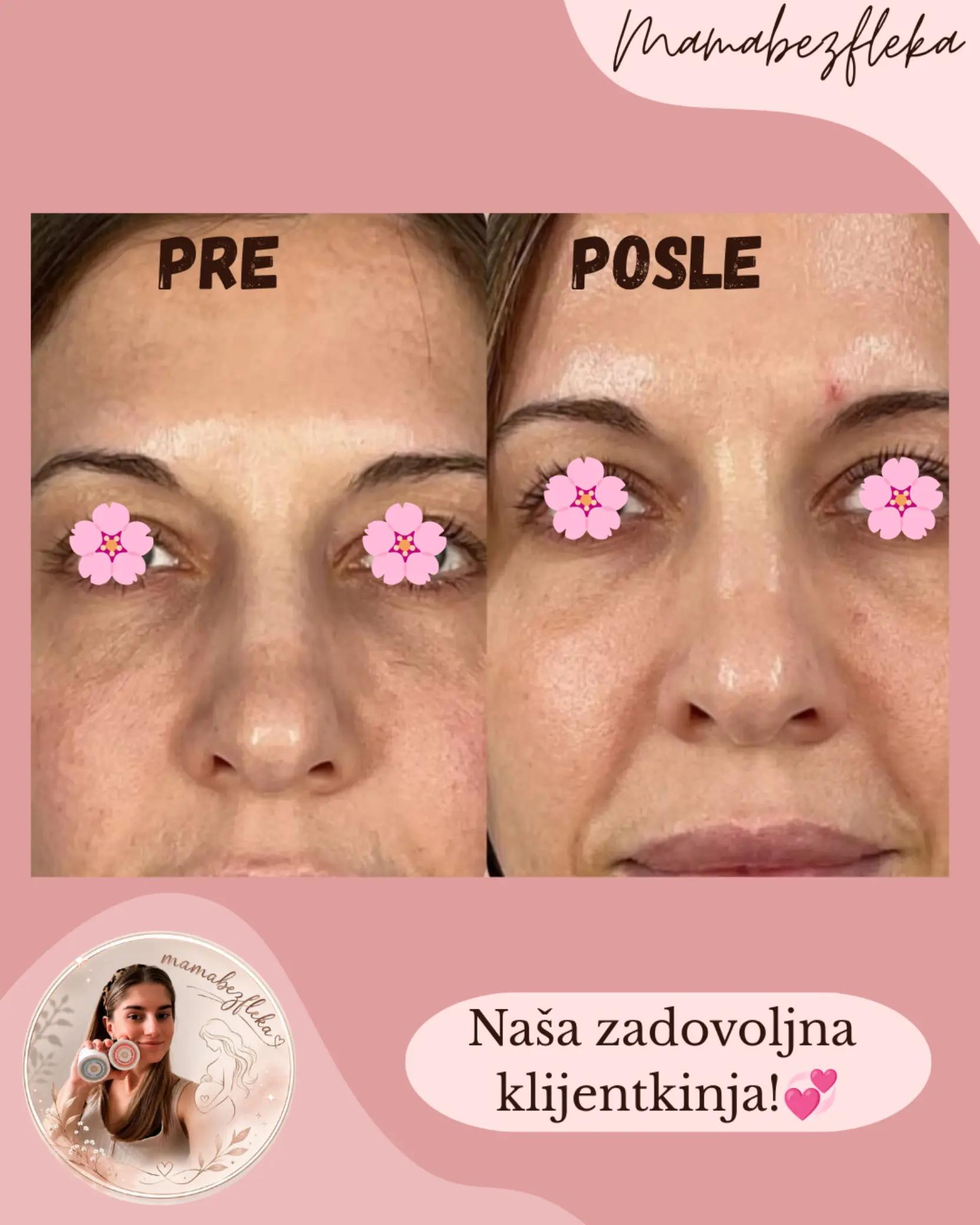 @Mama bez fleka