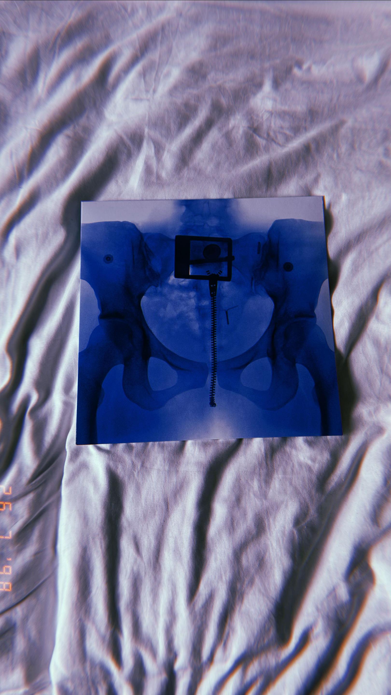 @sunsetz_vinyl