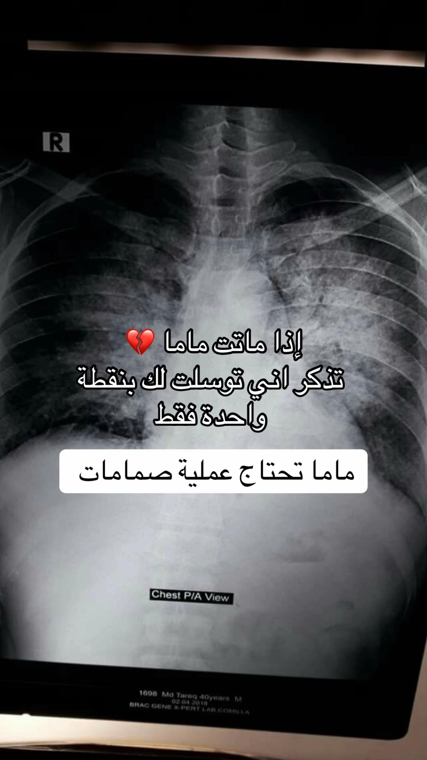 @MALAK