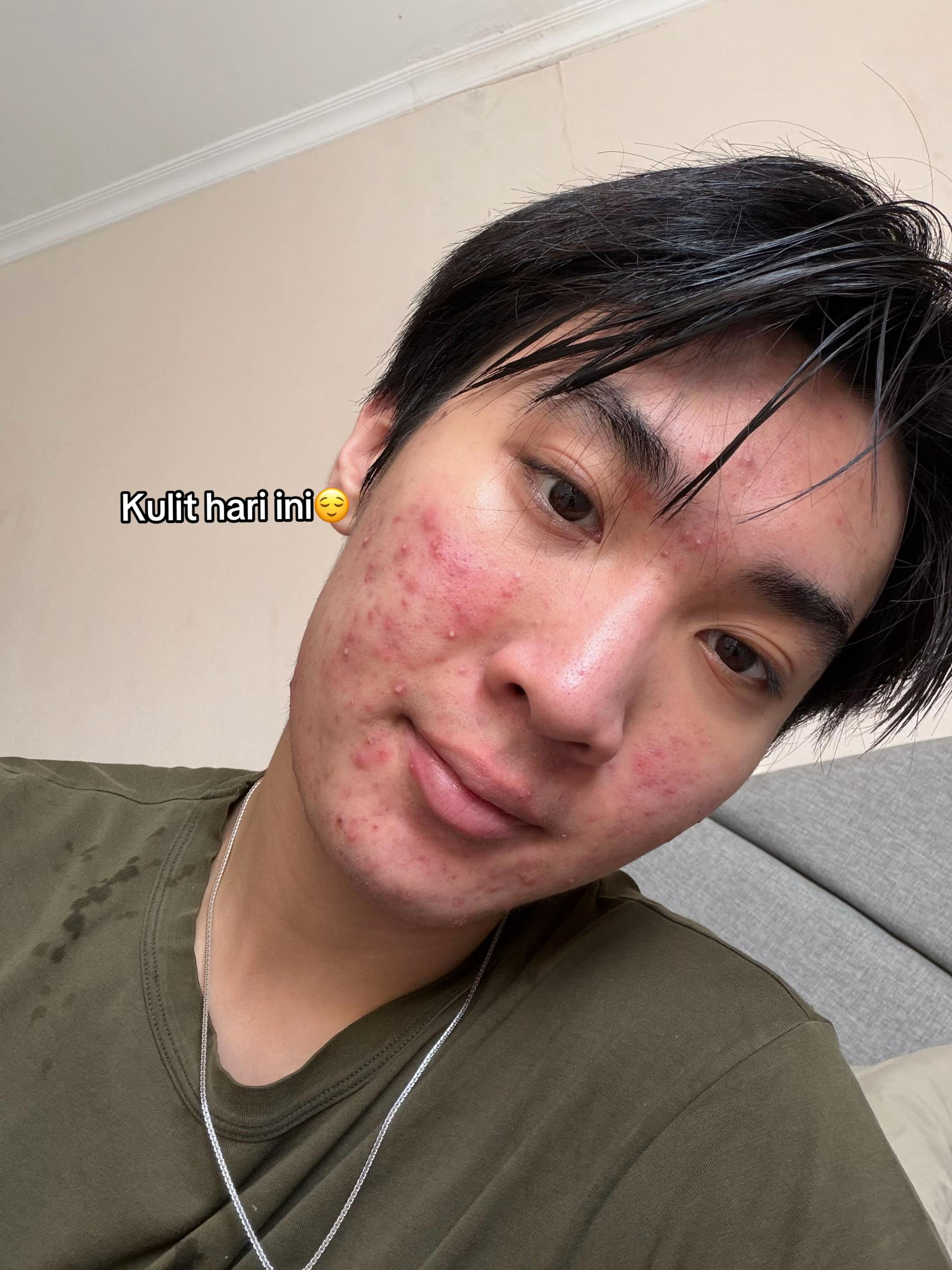 @Mau kulit sehat
