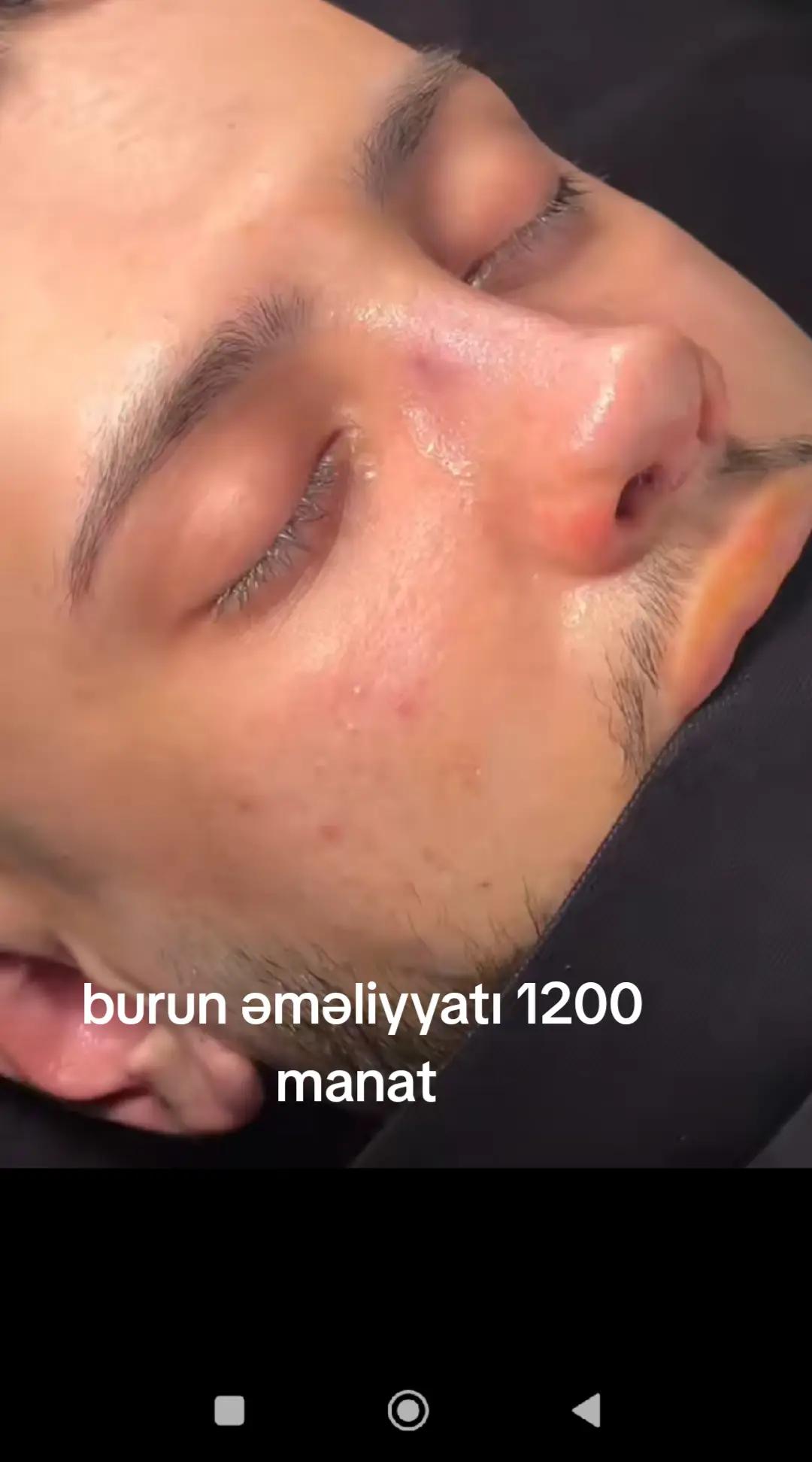 @rinoplastika_lor.dr.resad