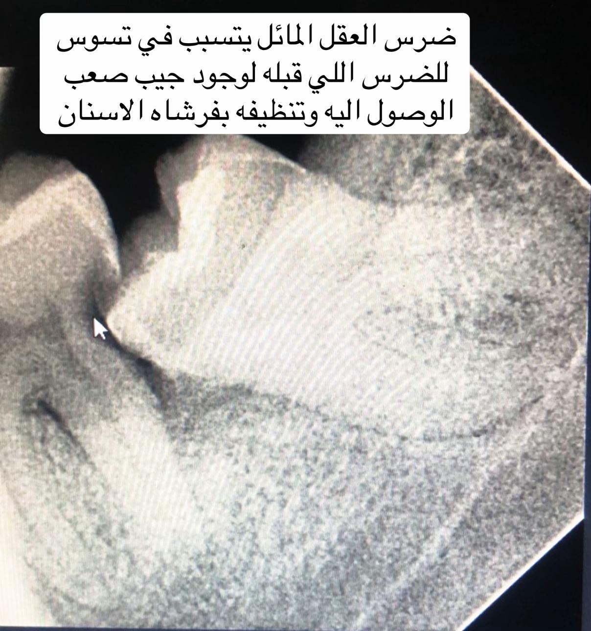 @Dr.Manar Samy