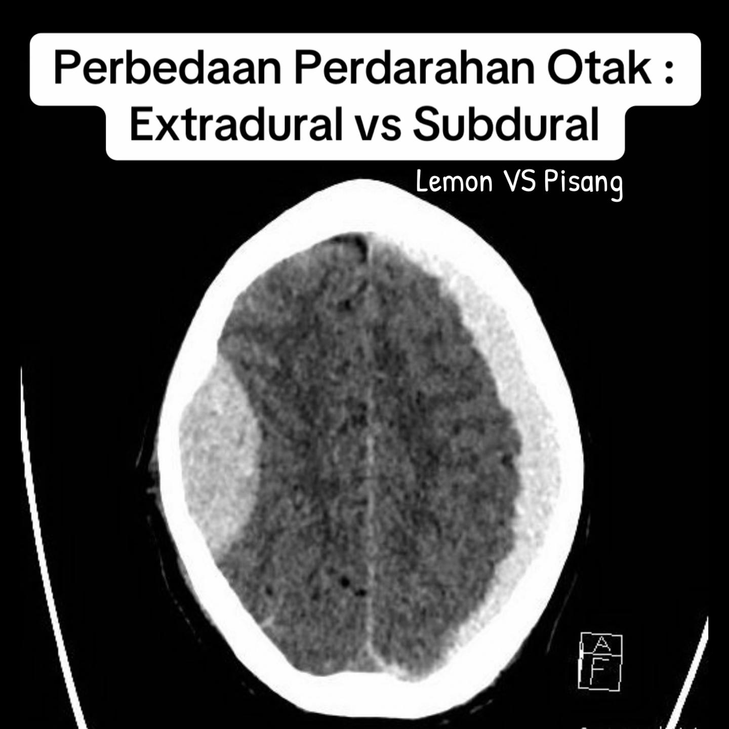 @Sobat Radiology