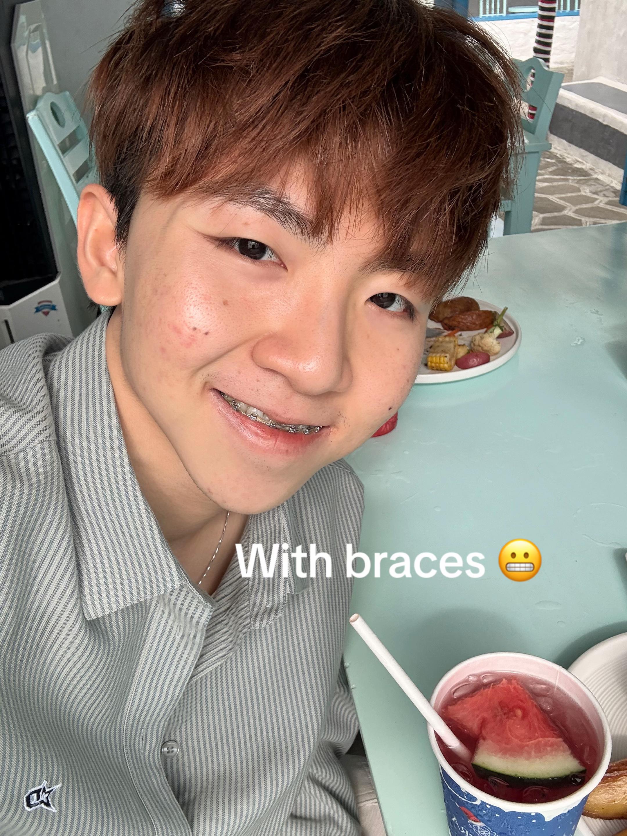 @Lucas☆