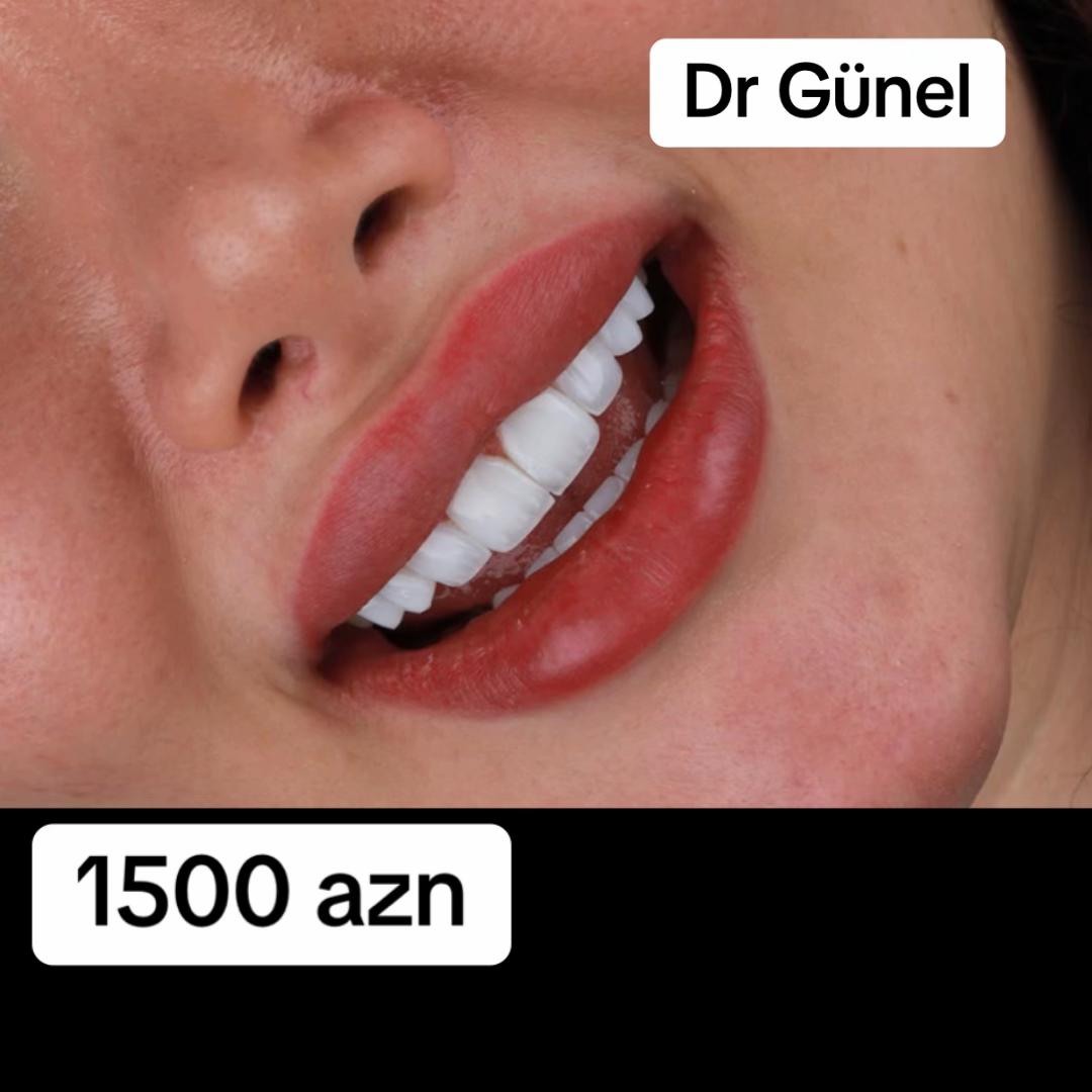 @Dentist_Günel