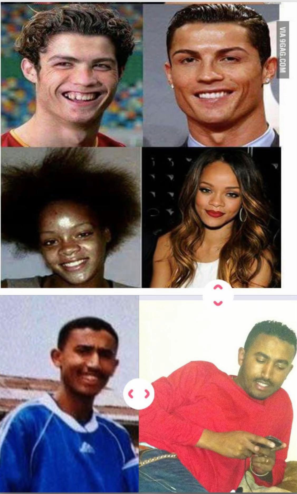 @Drዬ Alex Ze 🇪🇹🤌