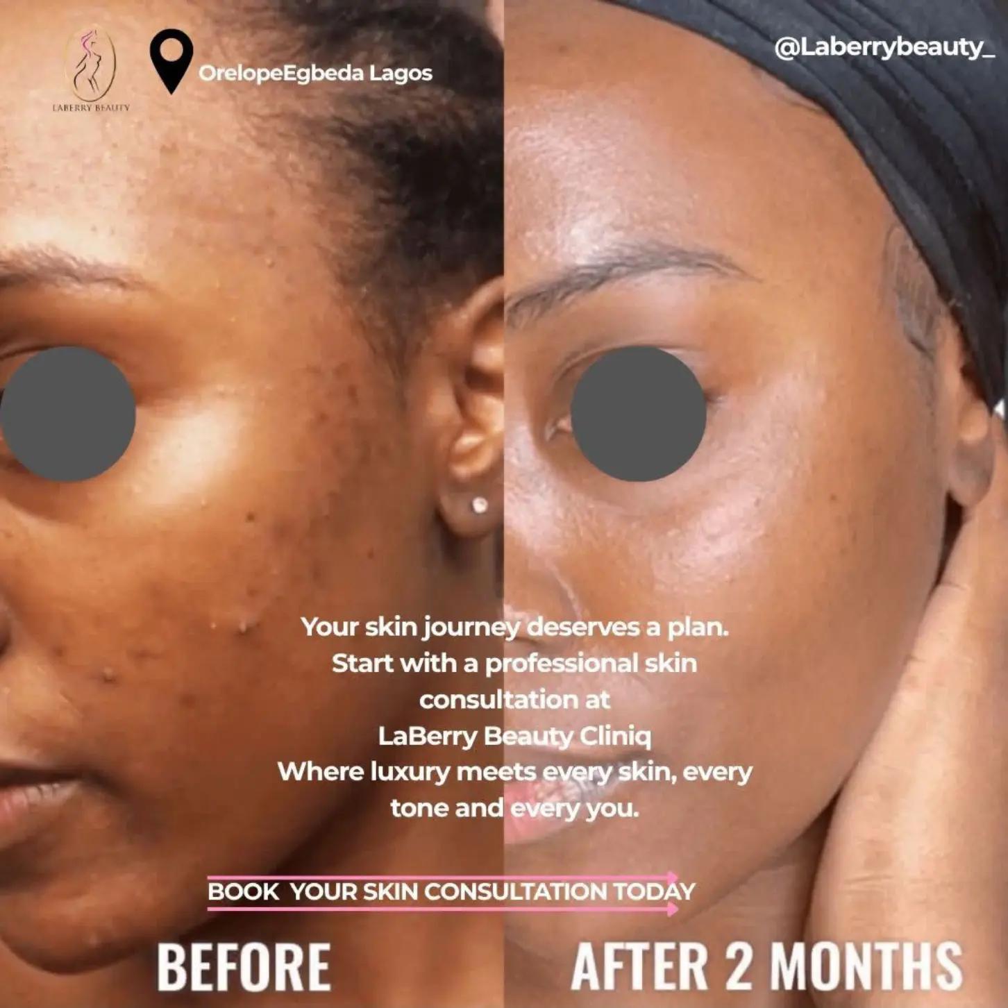 @LaBerry | Luxury Medspa Lagos