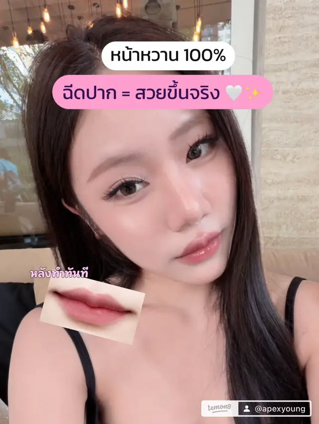 @APEXYOUNGCLINIC