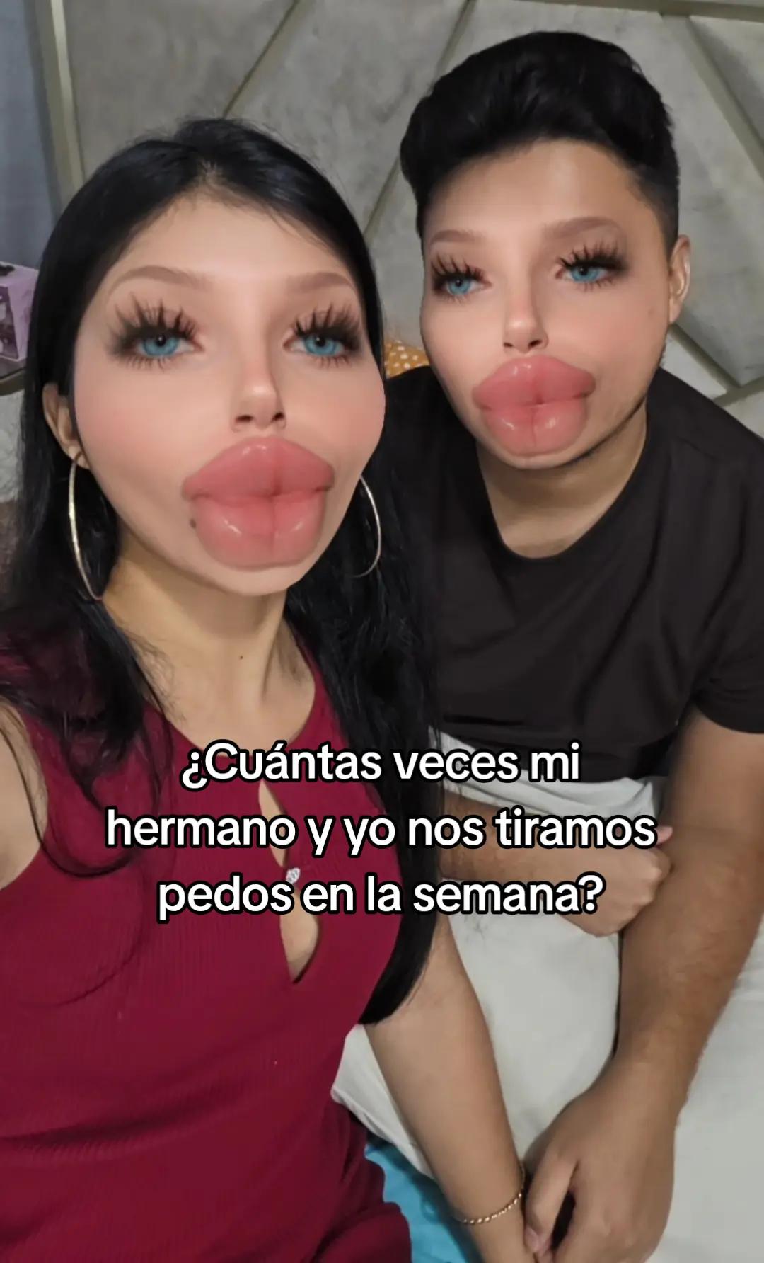 @Paéz
