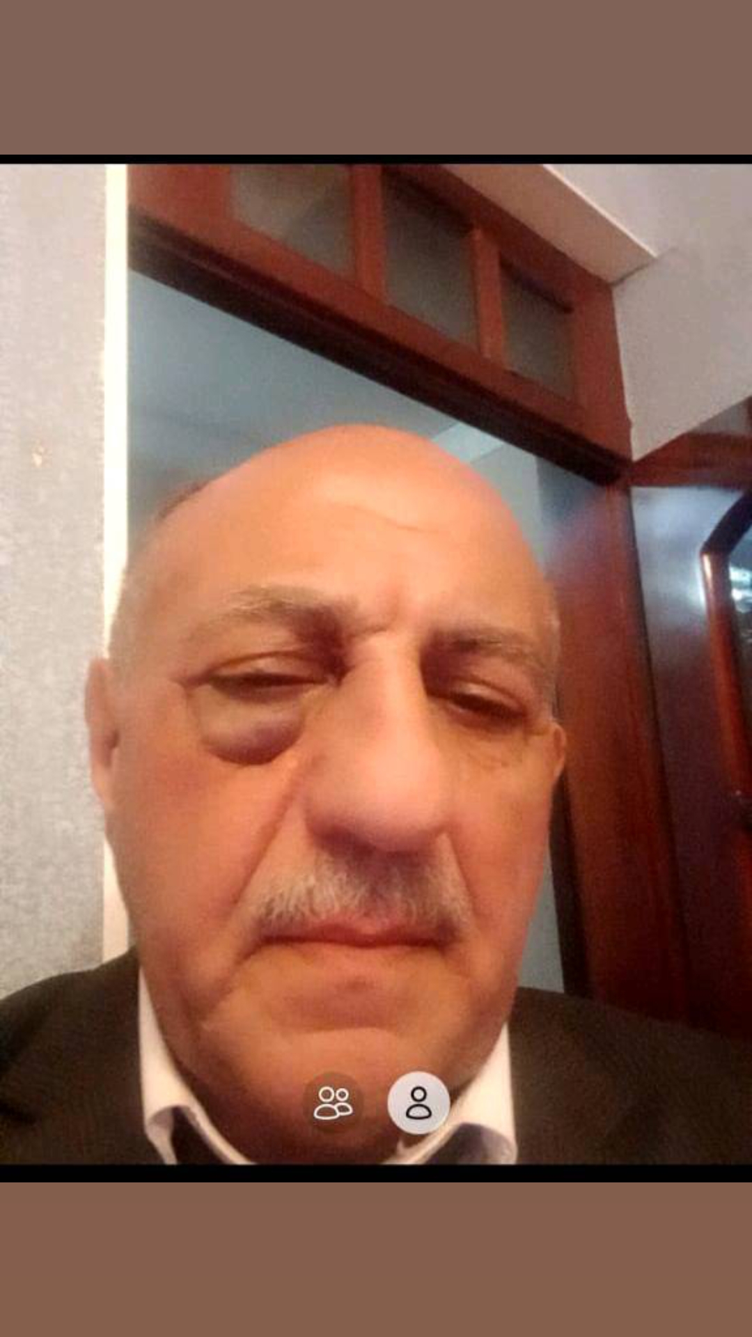 @Xirdalan