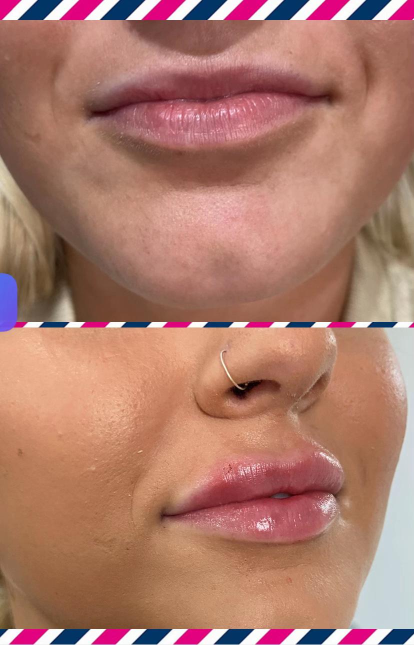 @Diamond Aesthetics Barnsley