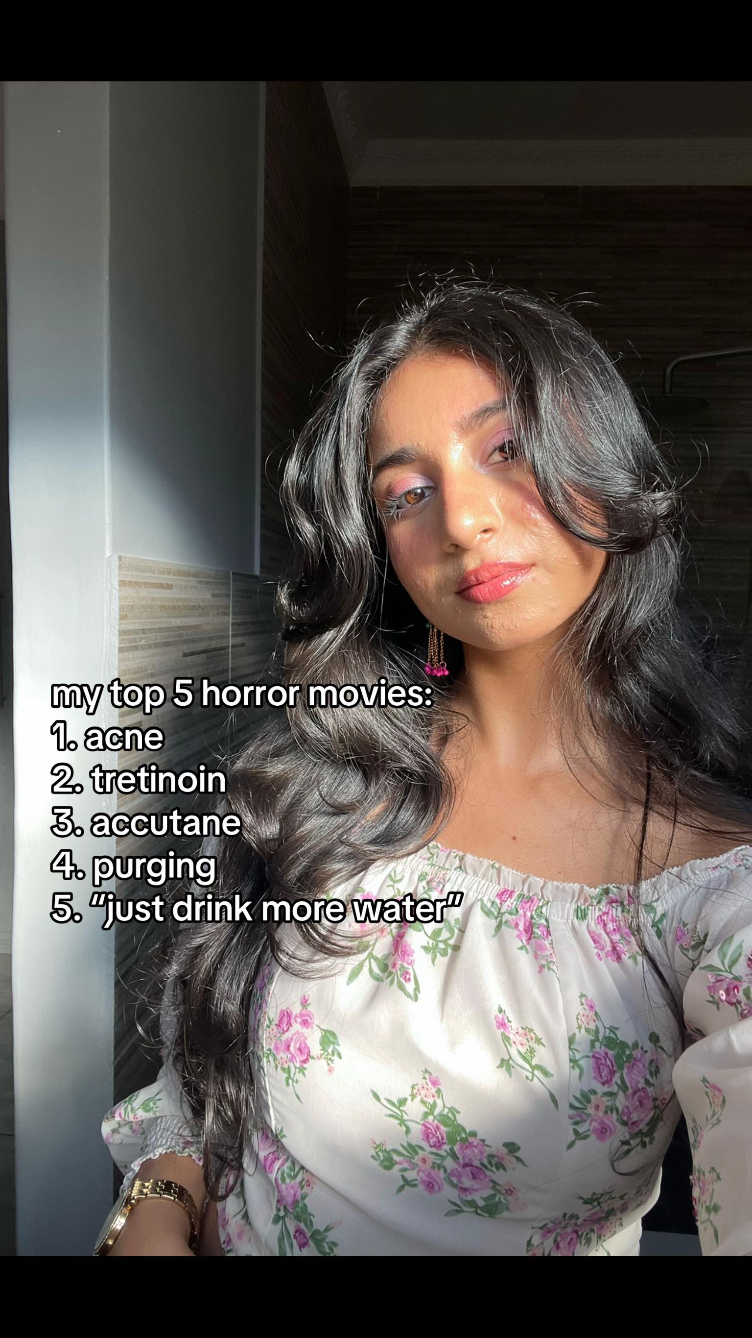 @Bhavika เฅ