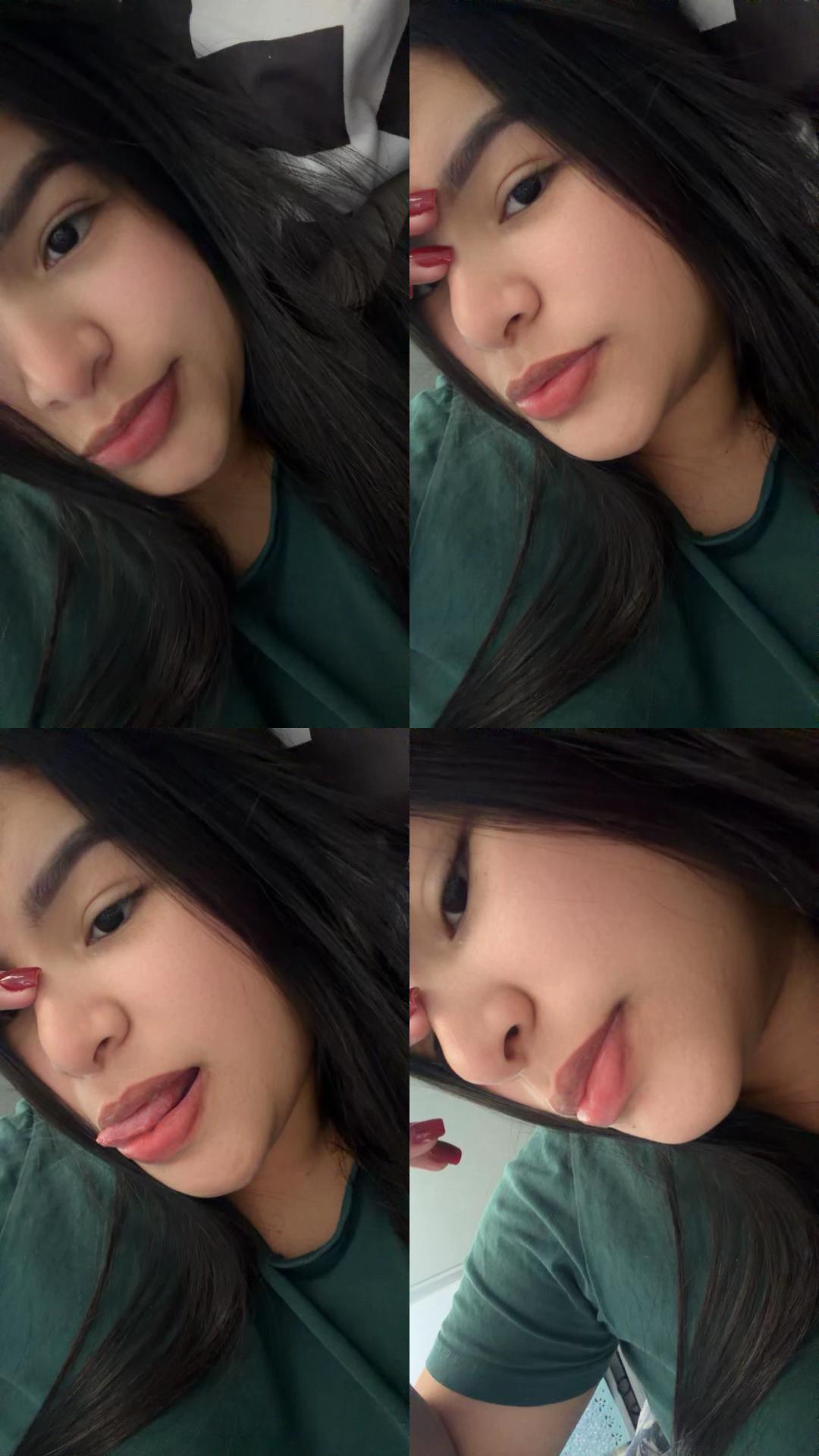 @Yaidilin Leidenz