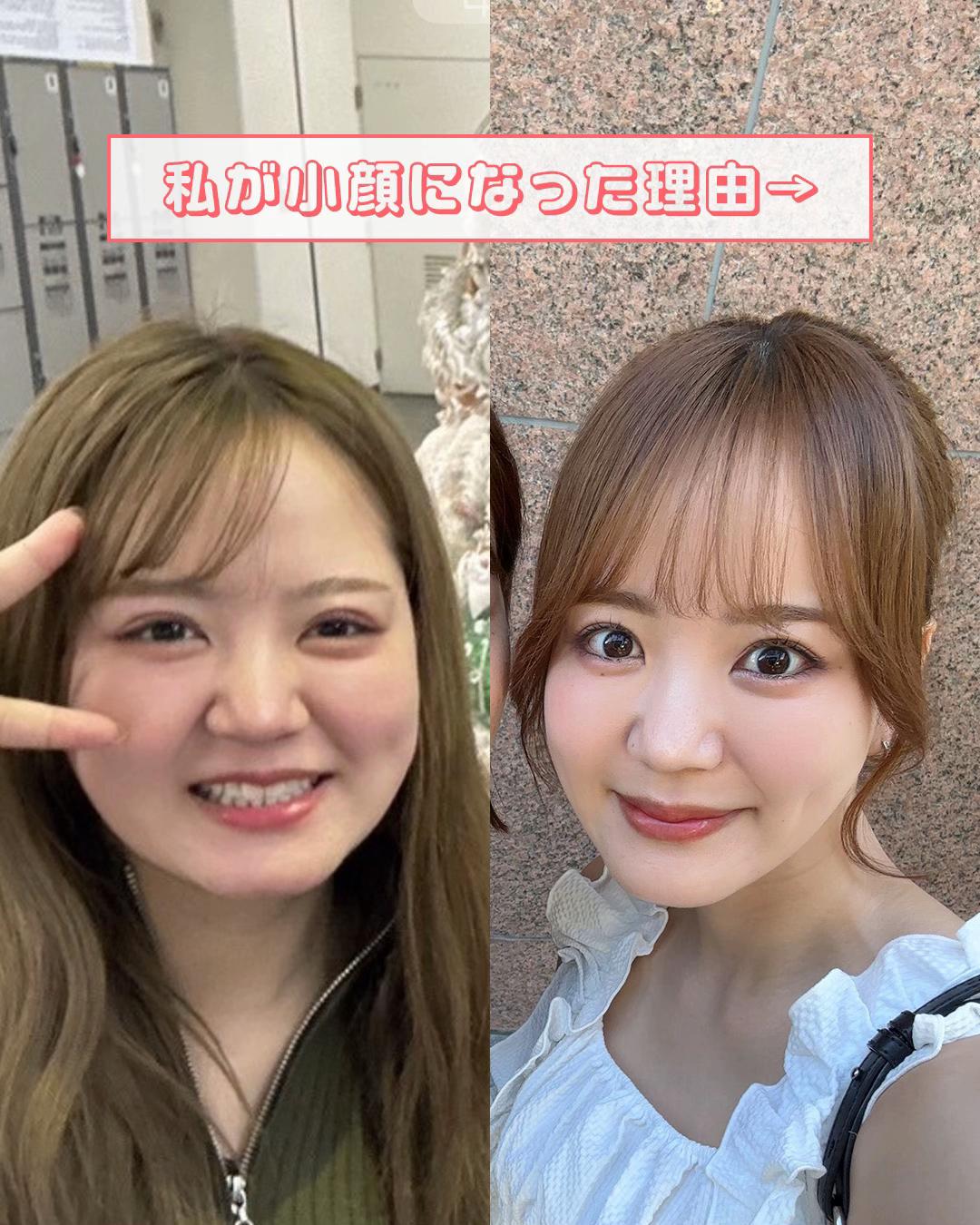 @名倉俊輔　輪郭.若返りの美容外科