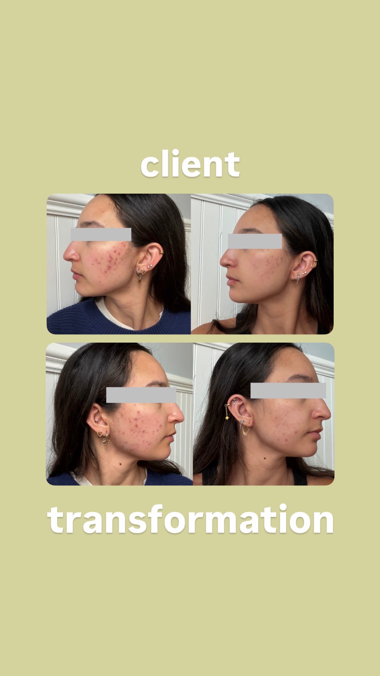 @Doctor Sheyda | Acne Expert