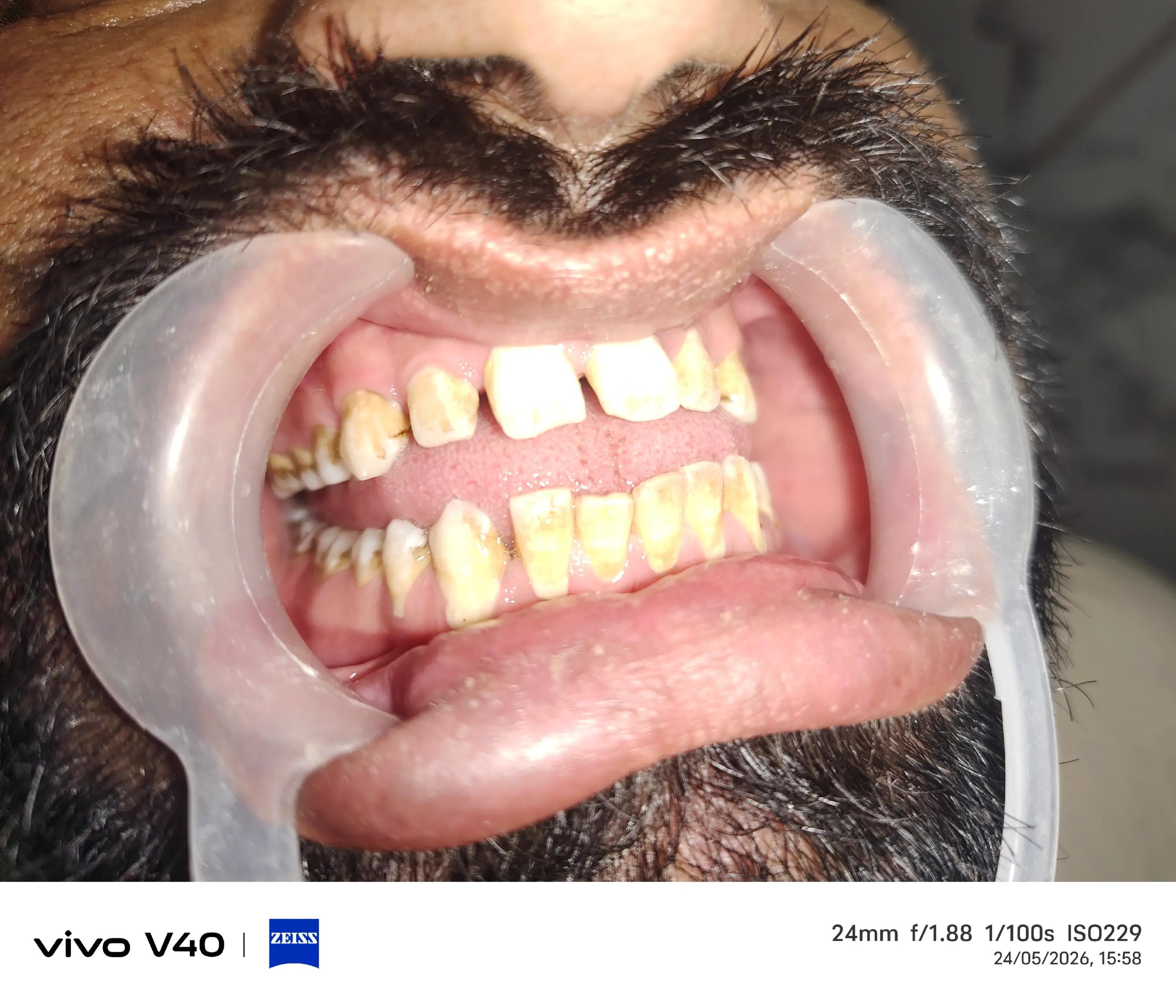 @Dental Clinic By Dr. Habib🦷