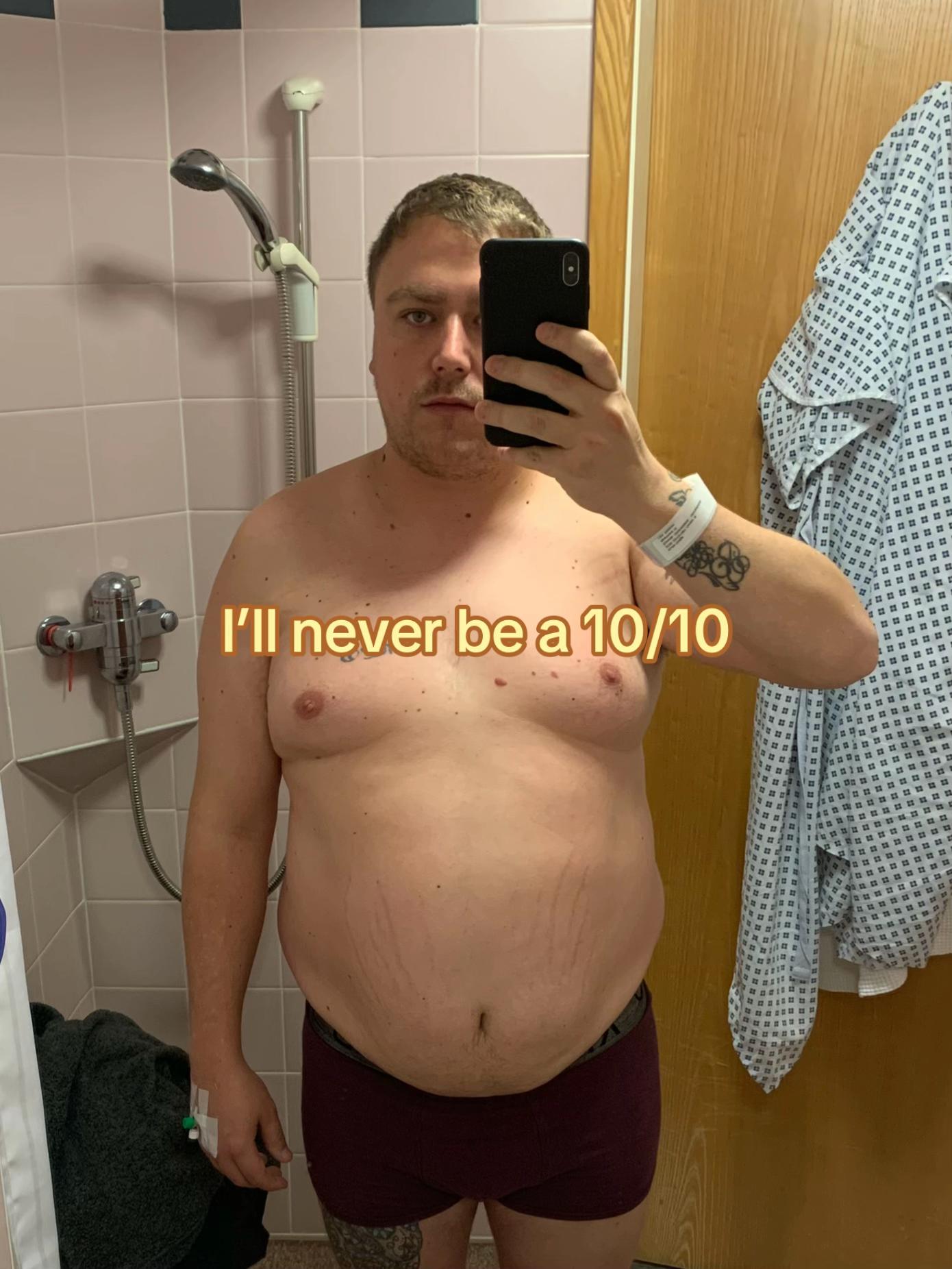 @KD | Life After Weight Loss