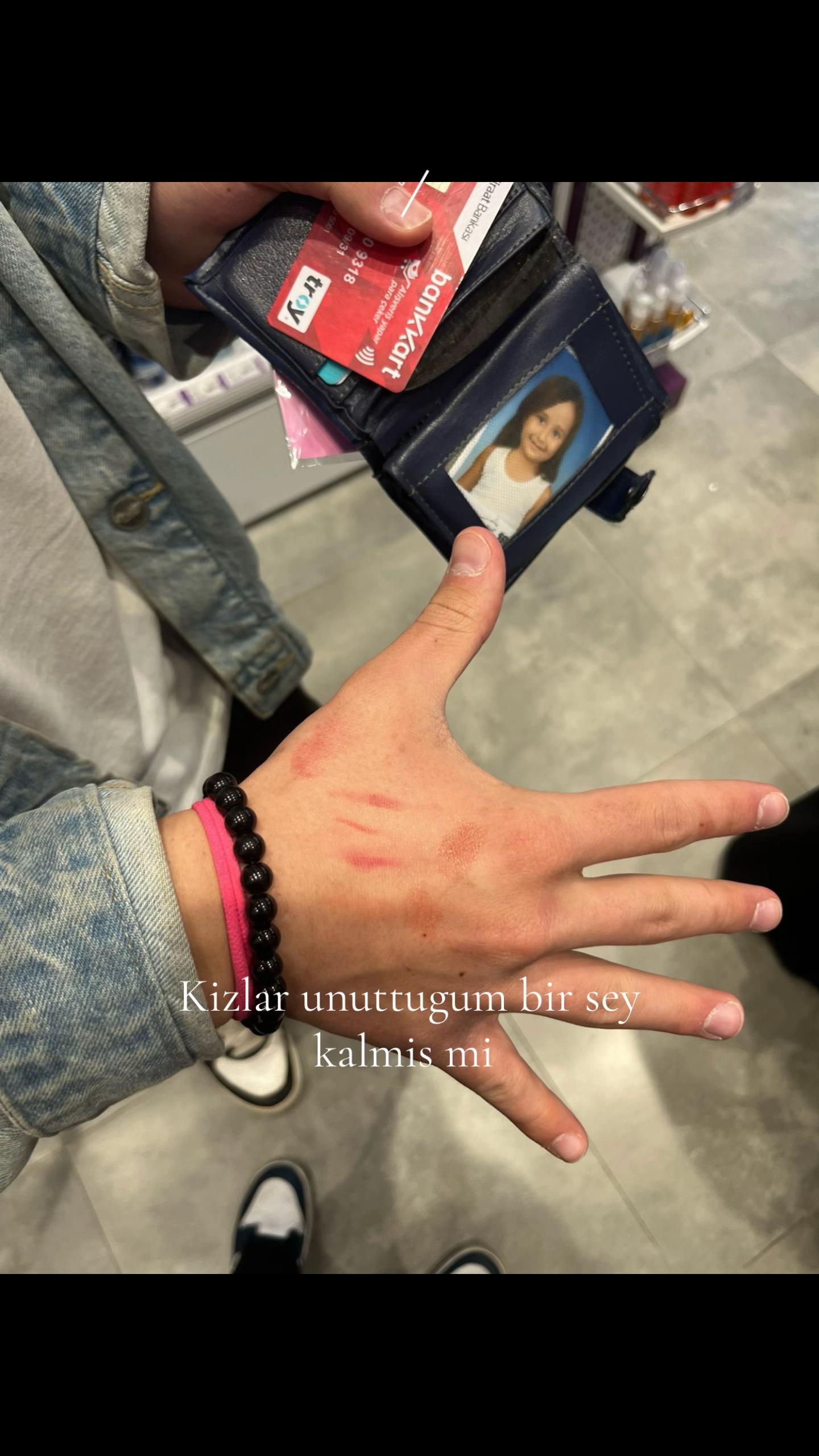 @Tuana