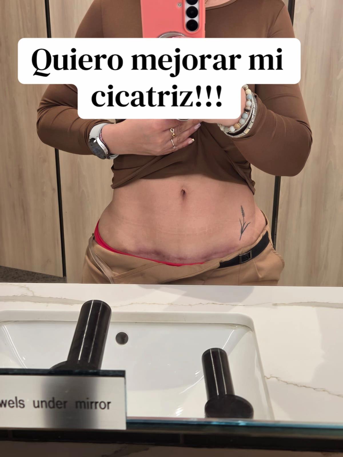 @Carla Panchana