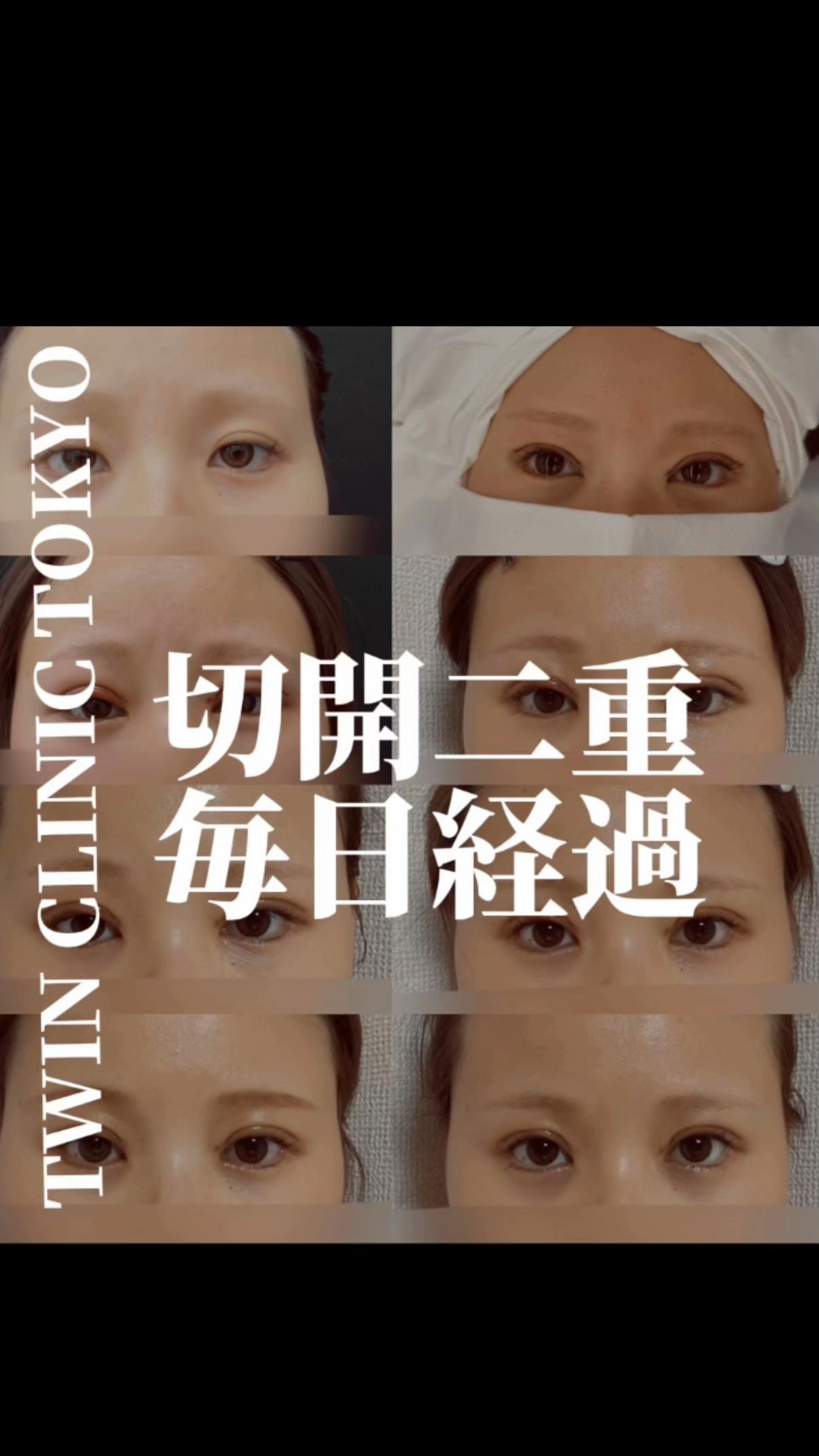 @dr_takeo_kimura