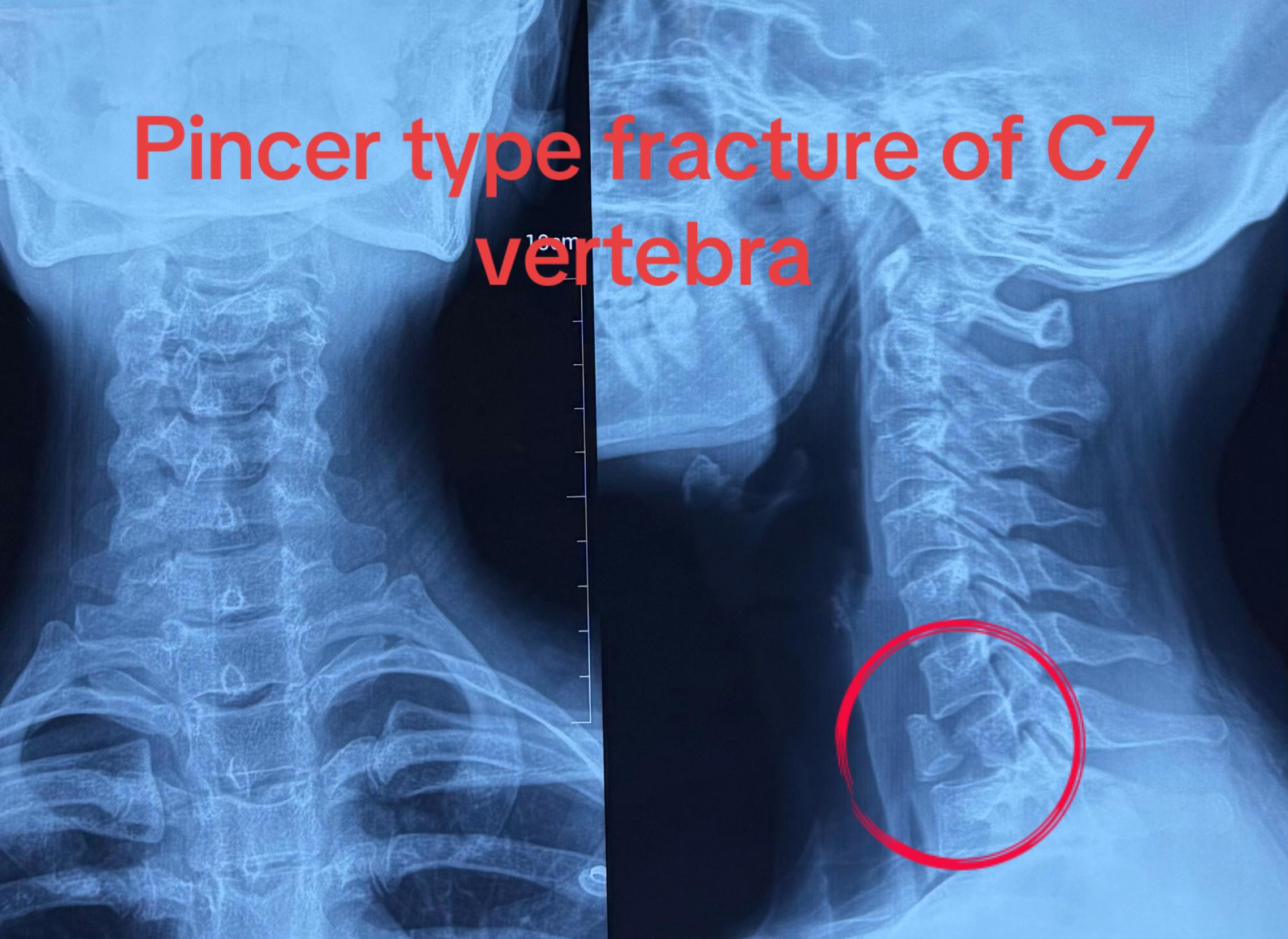 @Orthopedic_Surgeon_Arbind
