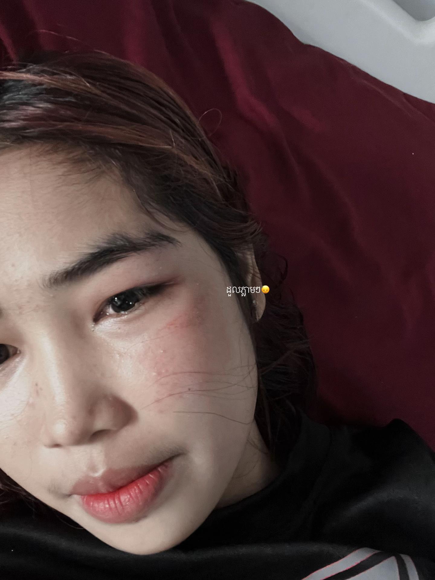 @កុមារា2Cm🫶🏻😾🗿