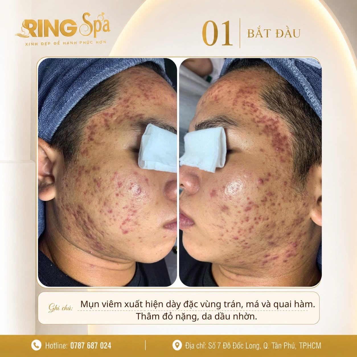 @Ring_Spa