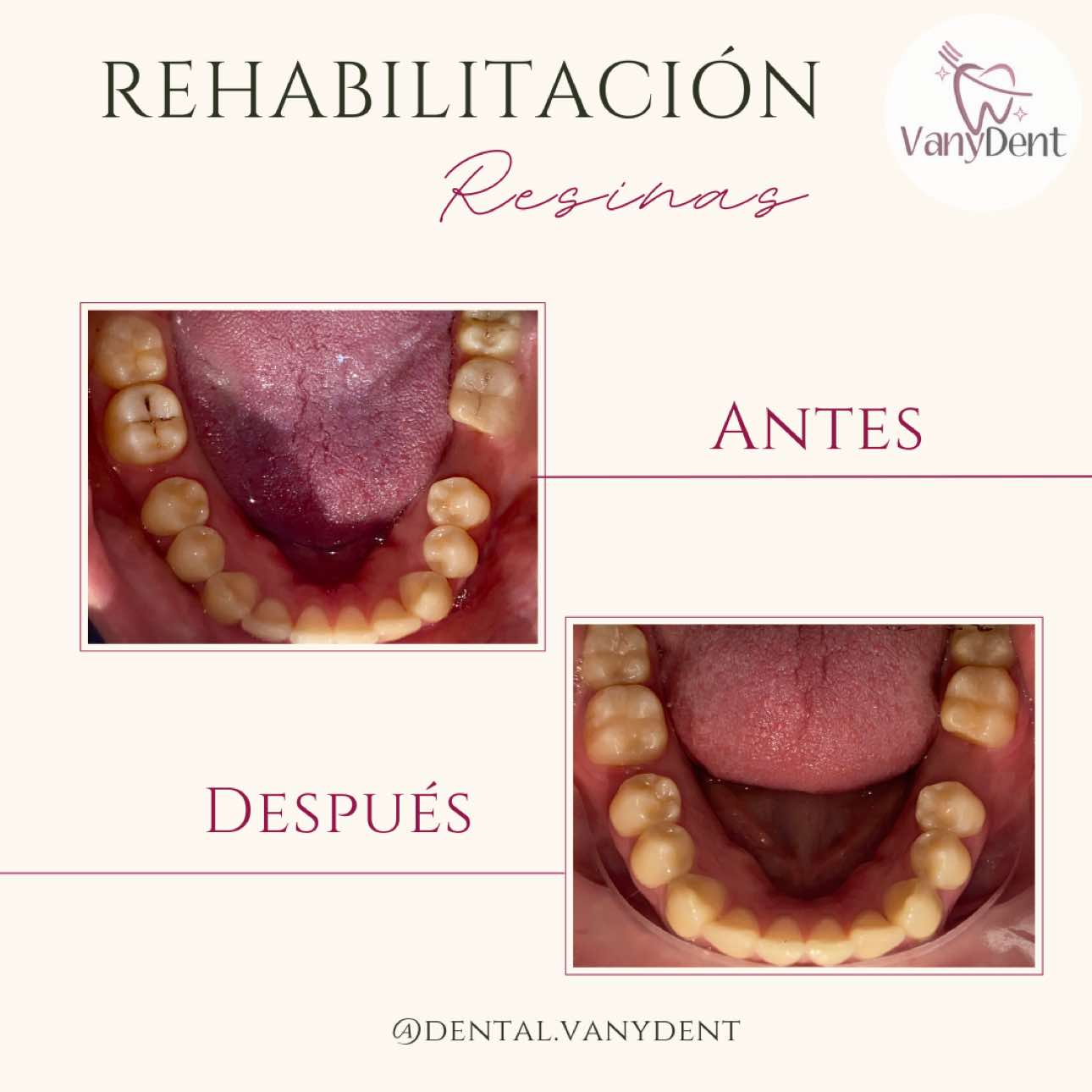 @Dental Vanydent