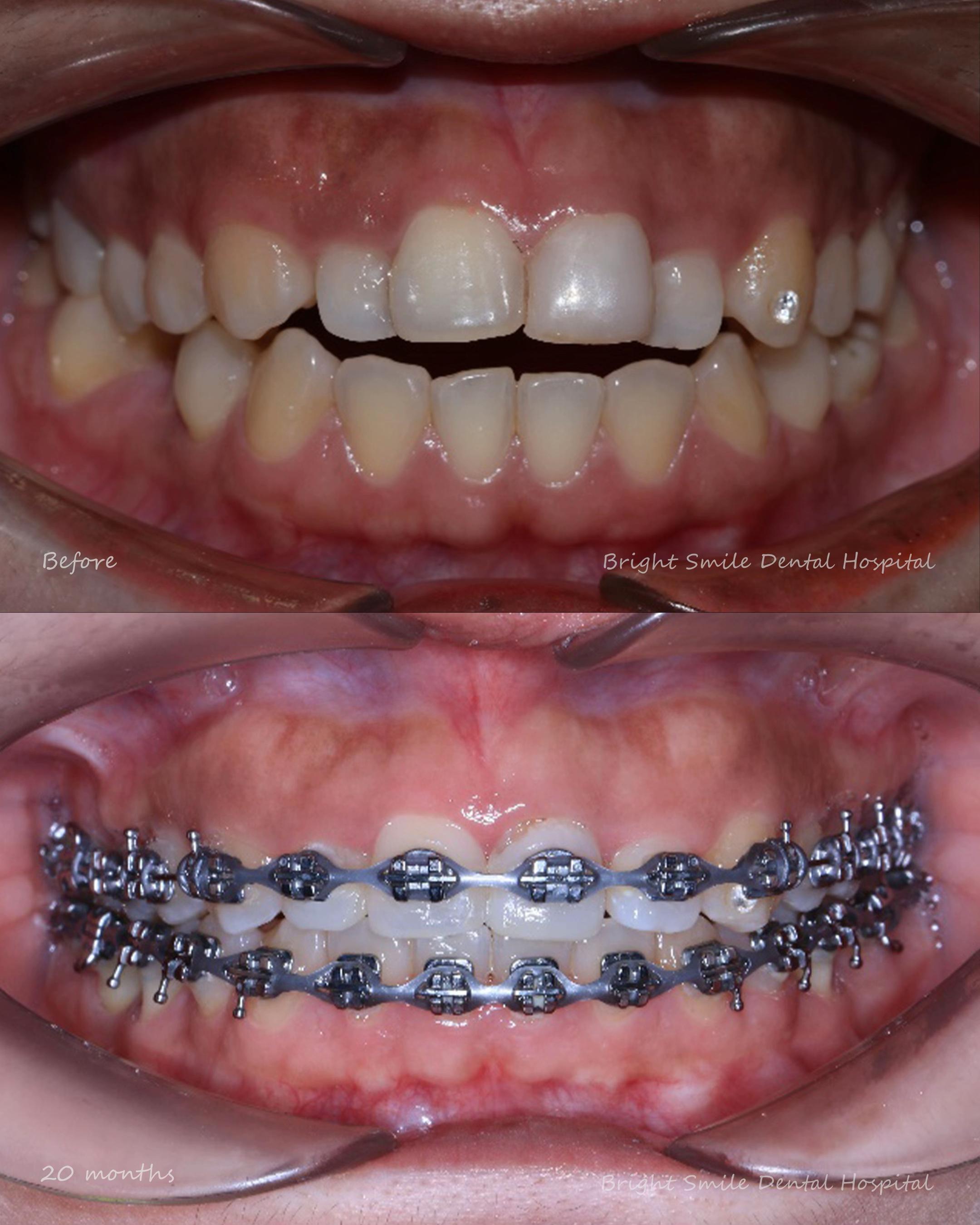 @BRIGHT SMILE DENTAL HOSPITAL