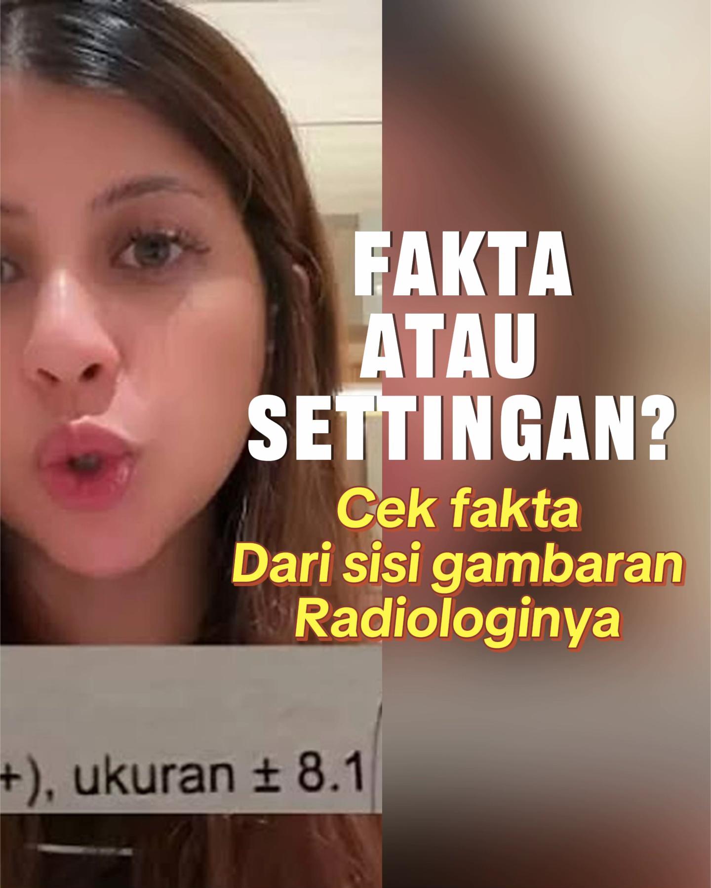 @Sobat Radiology
