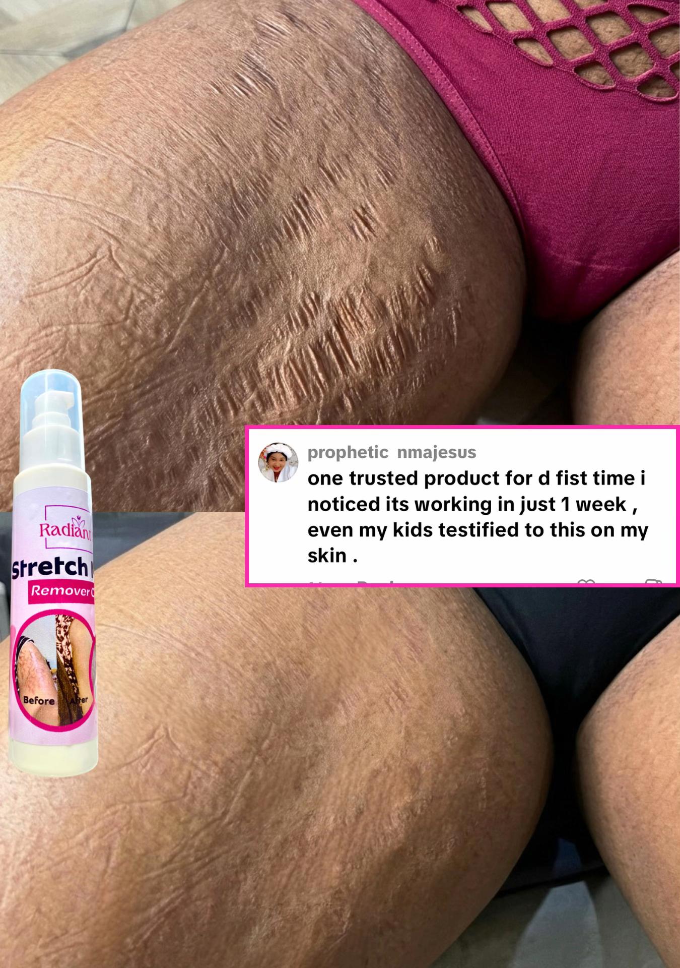 @Radiant skin