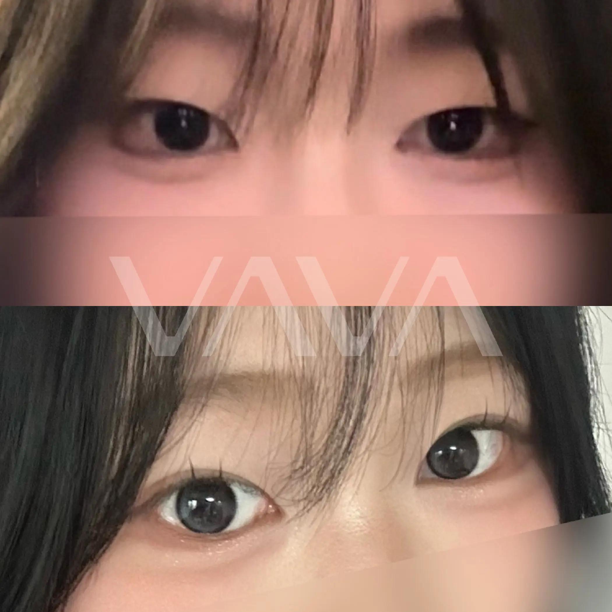 @VAVA美容整形外科