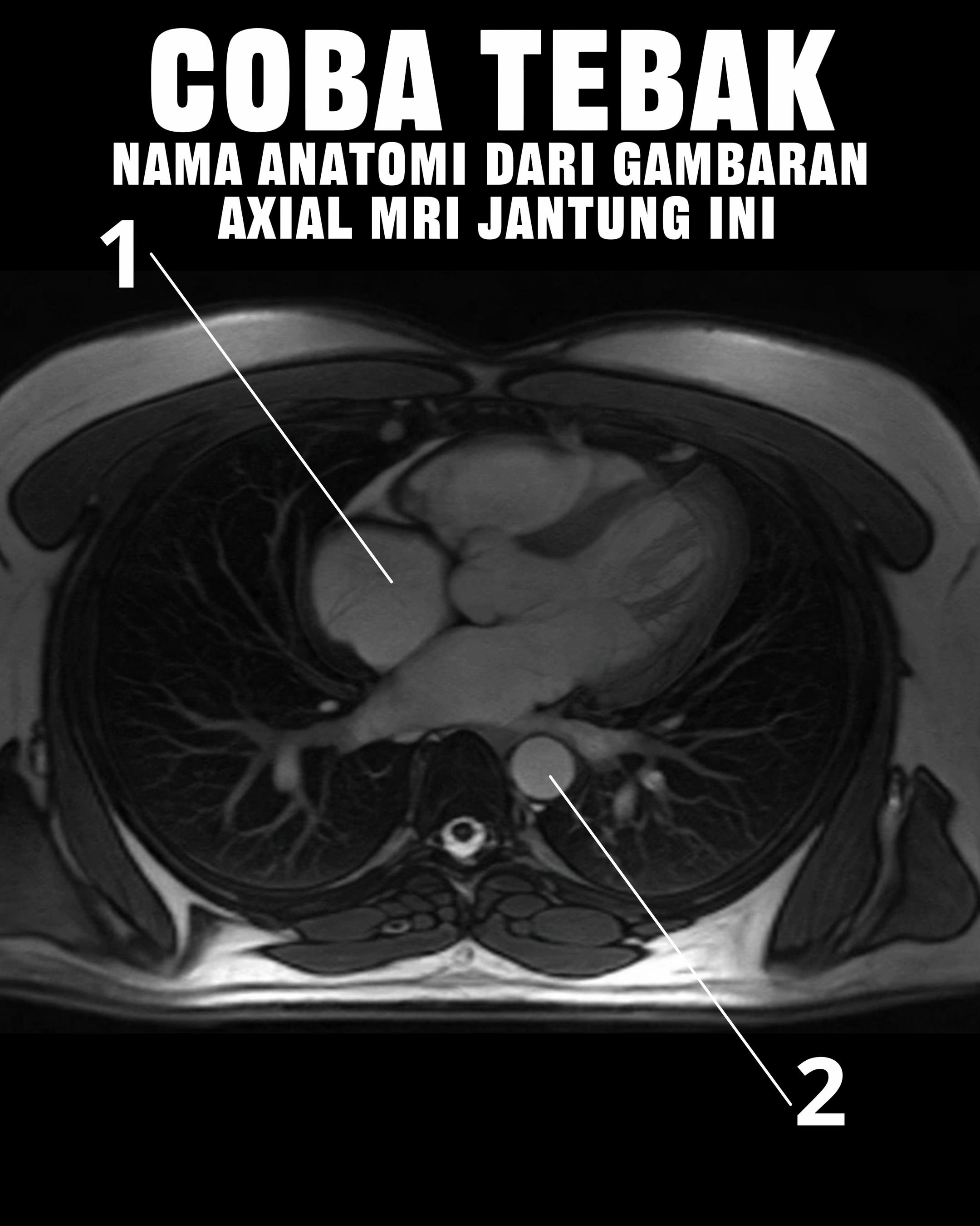 @Sobat Radiology