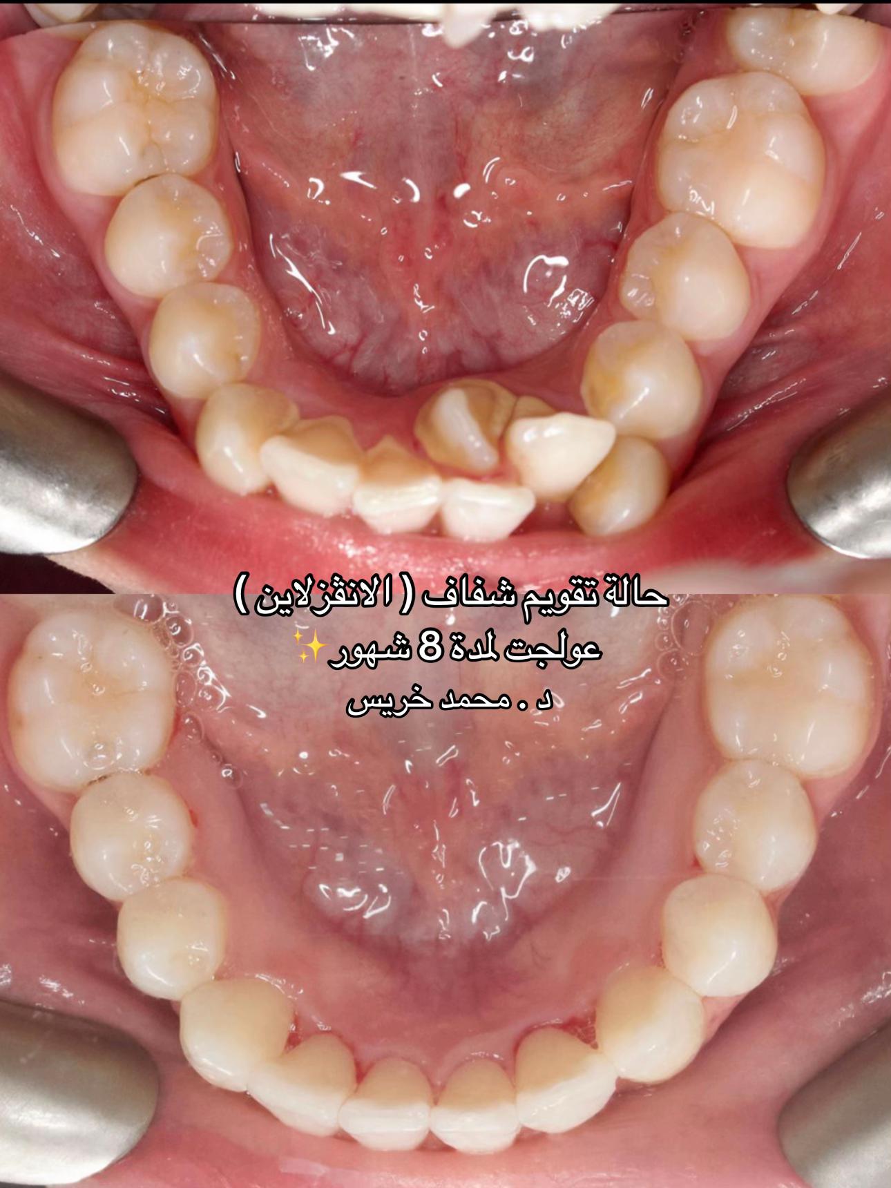 @مركز مزدانه 1 ( فرع الصحافه )