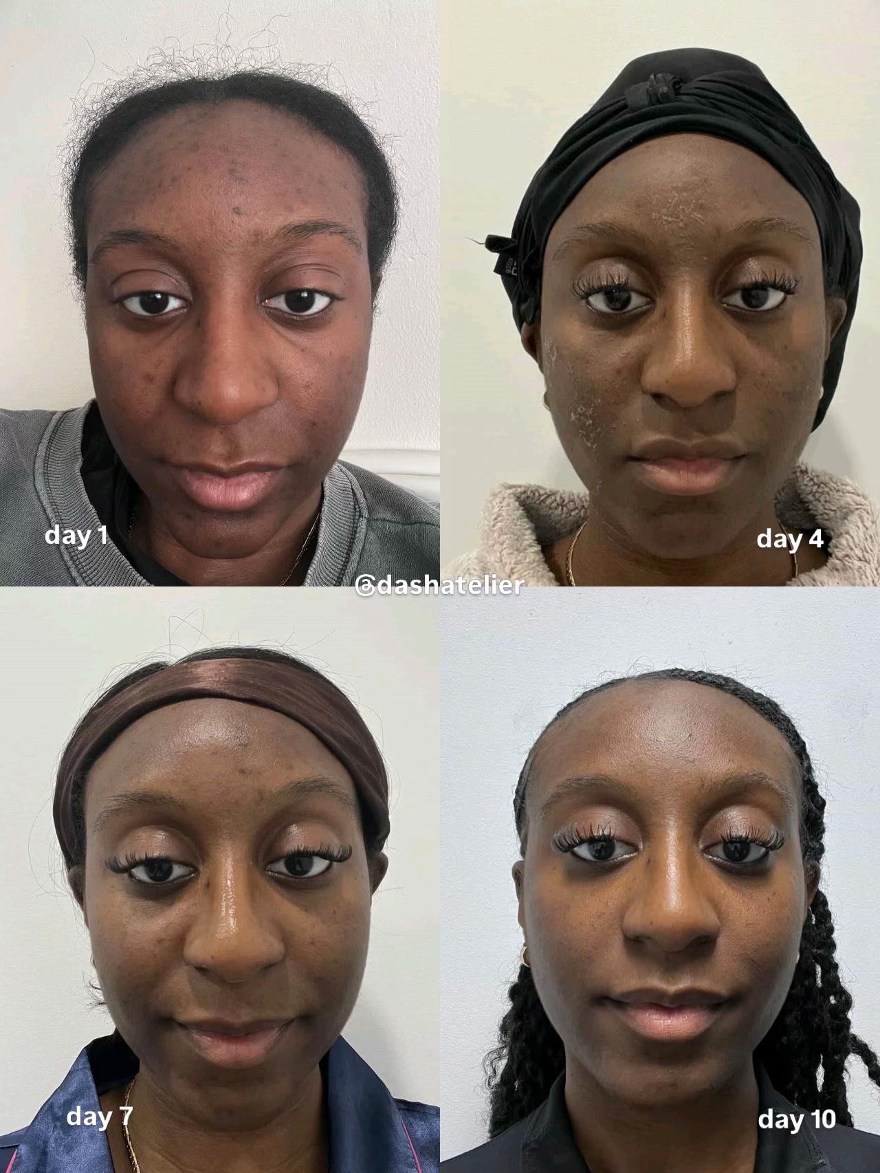 @MONTREAL SKINCARE SPECIALIST