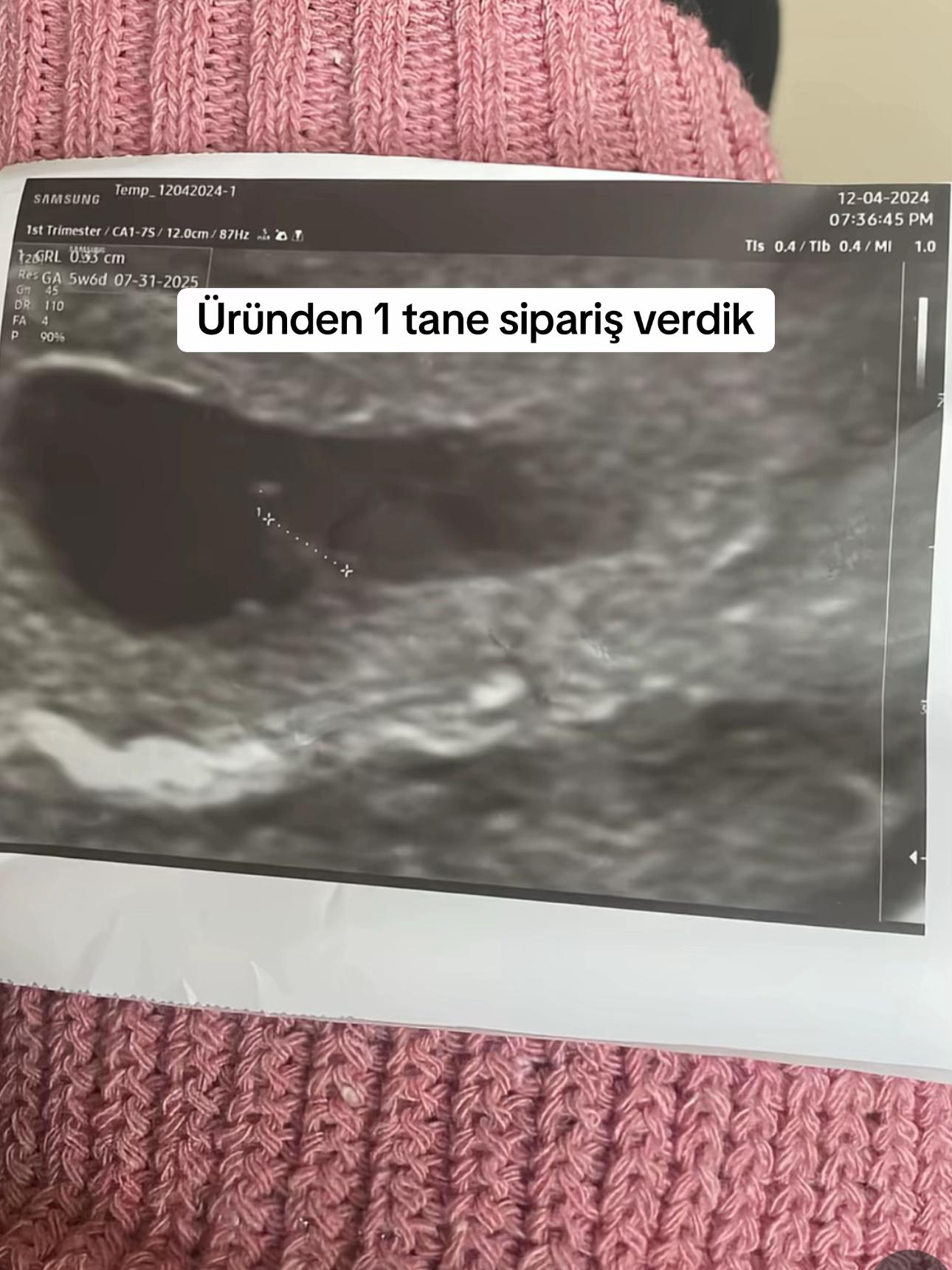 @İroşşş ve ikizlerin.g&uuml;nl&uuml;ğ&uuml;