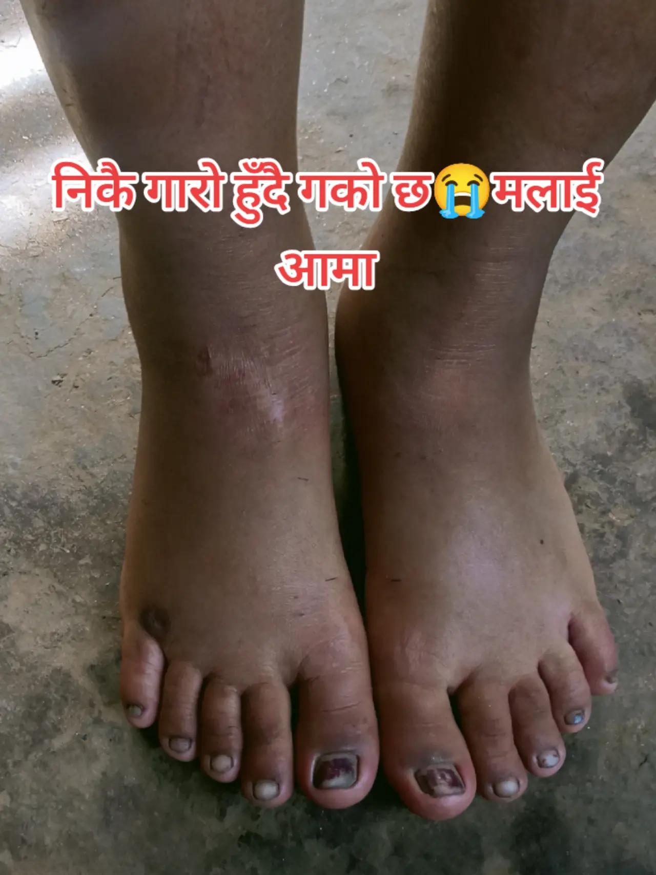 @bharat@ sirjana
