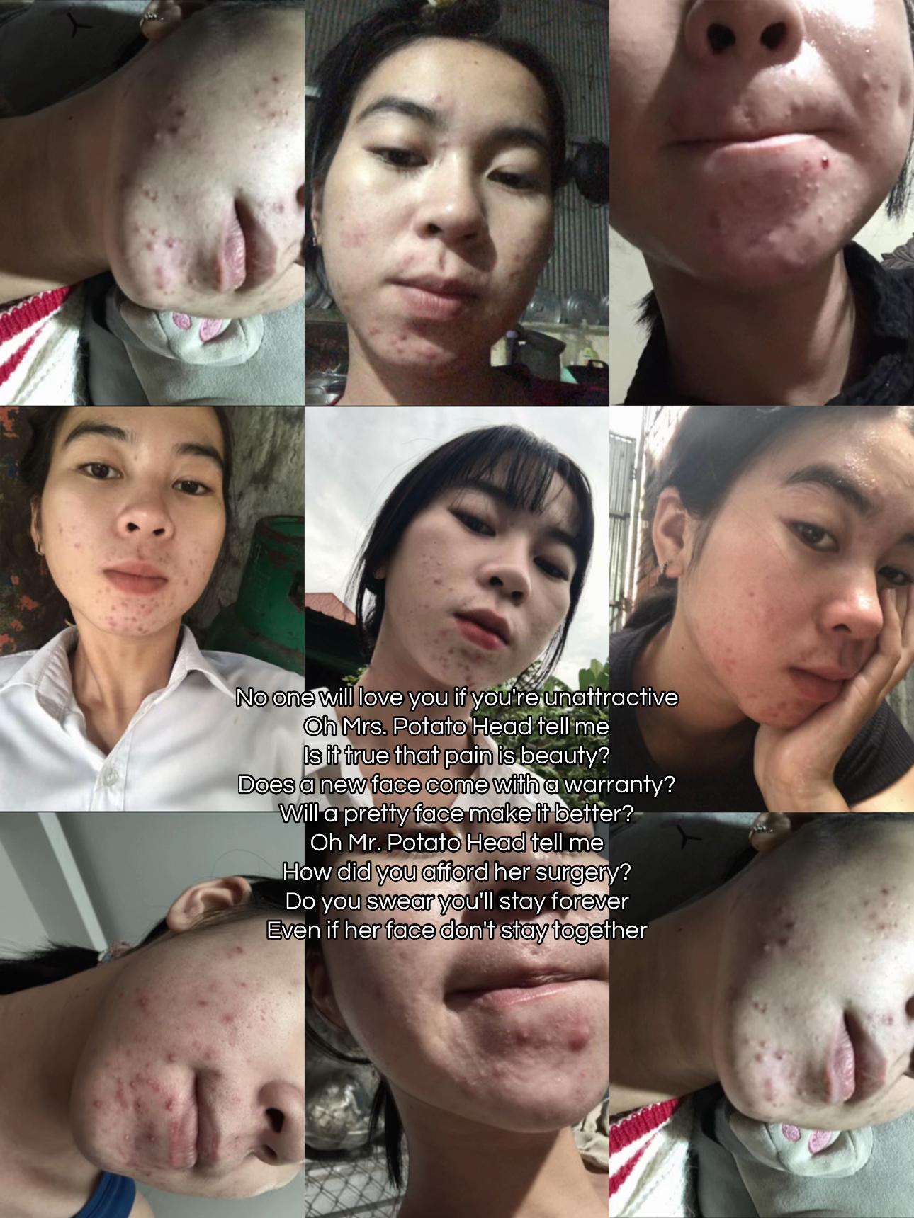 @ប្រាកដ សុភ័ទ្ទពេជ្រ-PortPich