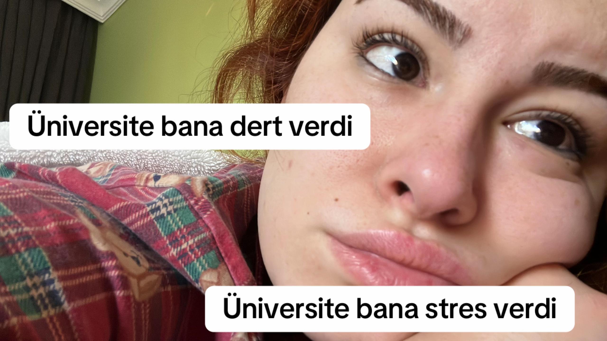 @Ecem AKYOL