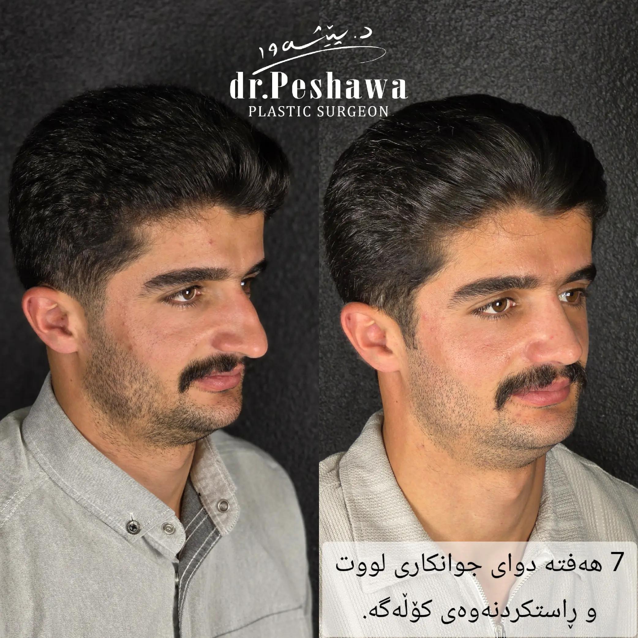@Dr. Peshawa Plastic Surgeon