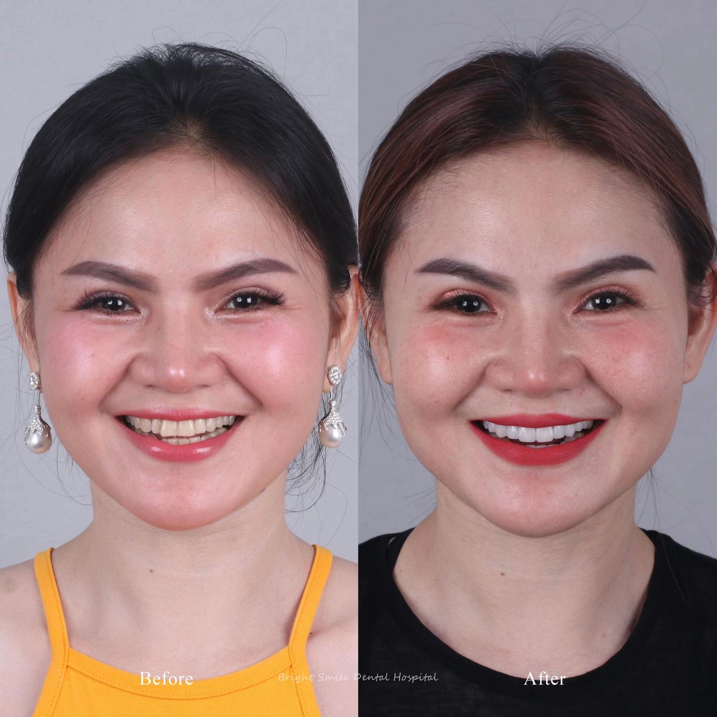 @BRIGHT SMILE DENTAL HOSPITAL
