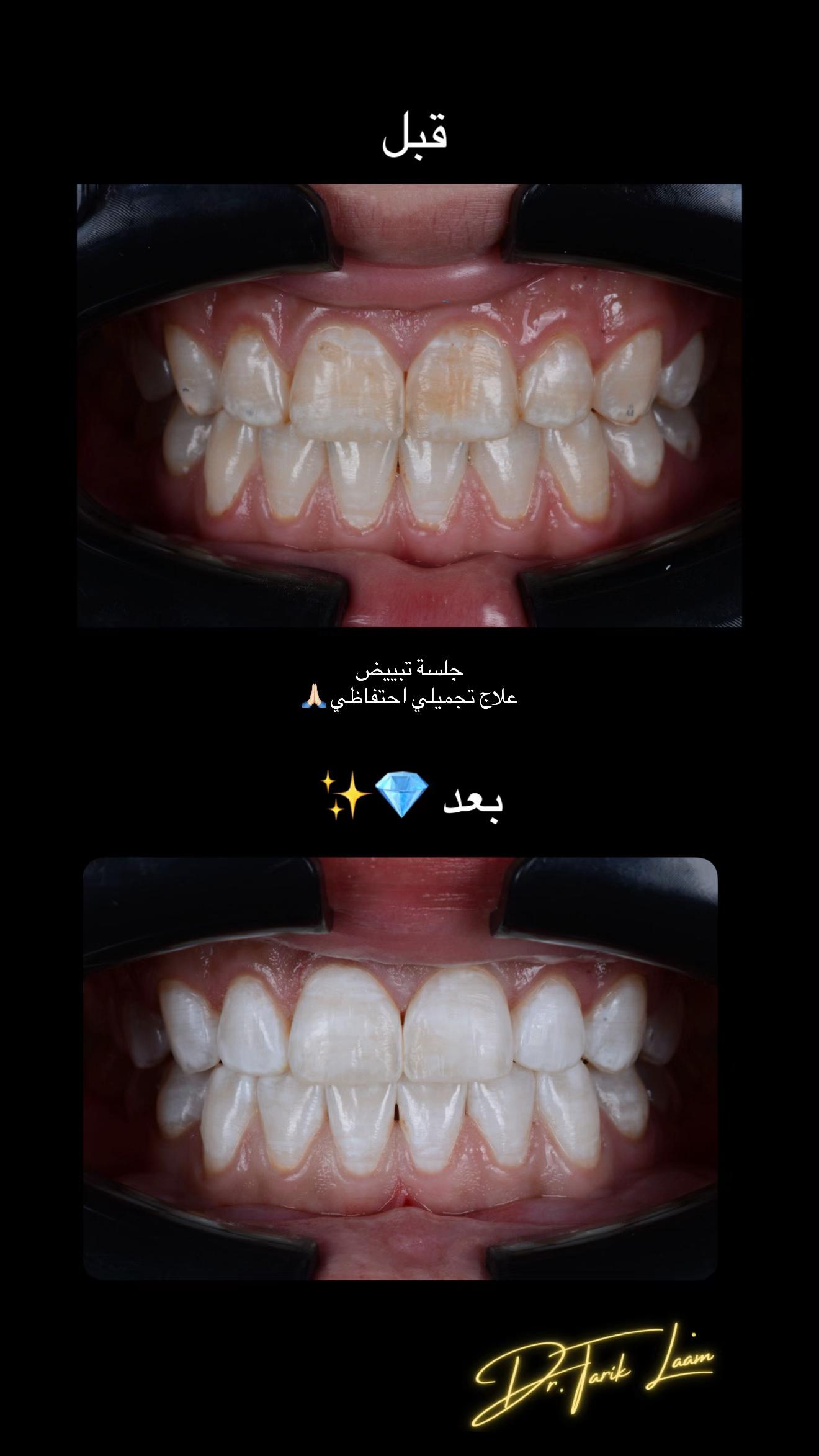 @Dr.tarik_laam
