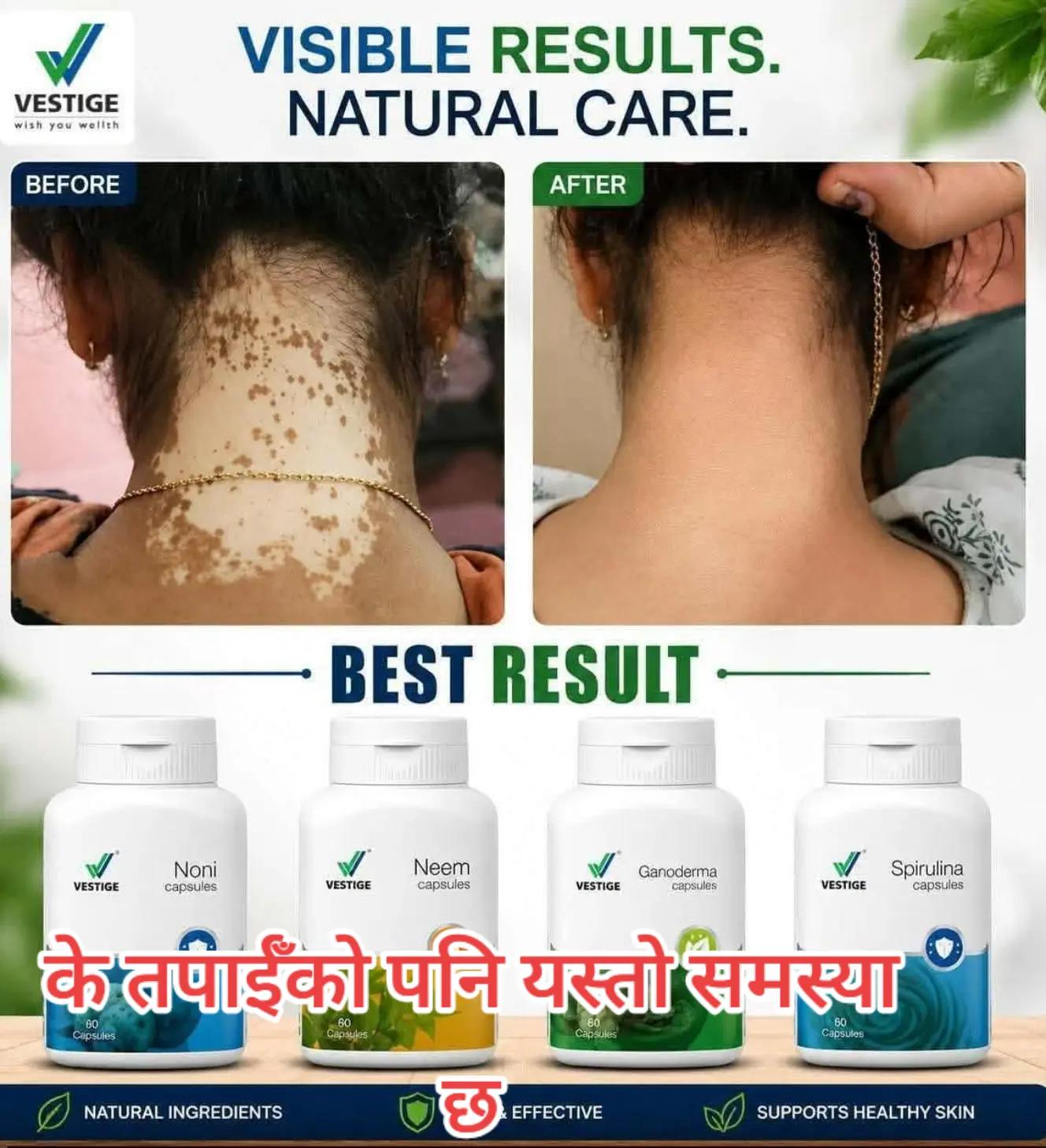 @deepraj Jaisi