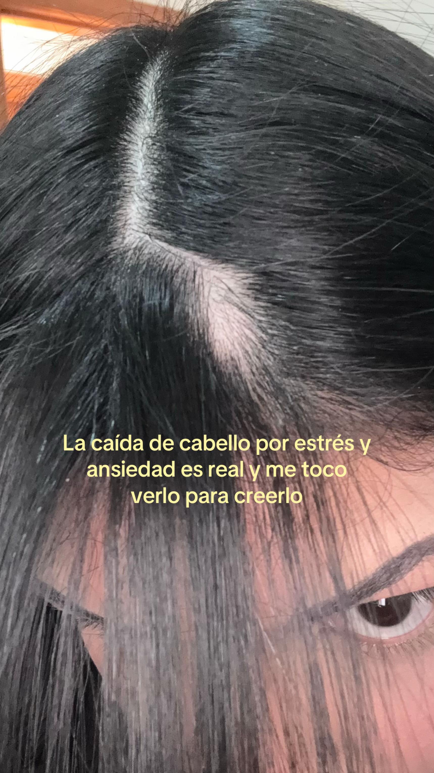 @Yvonne Michel⭐️