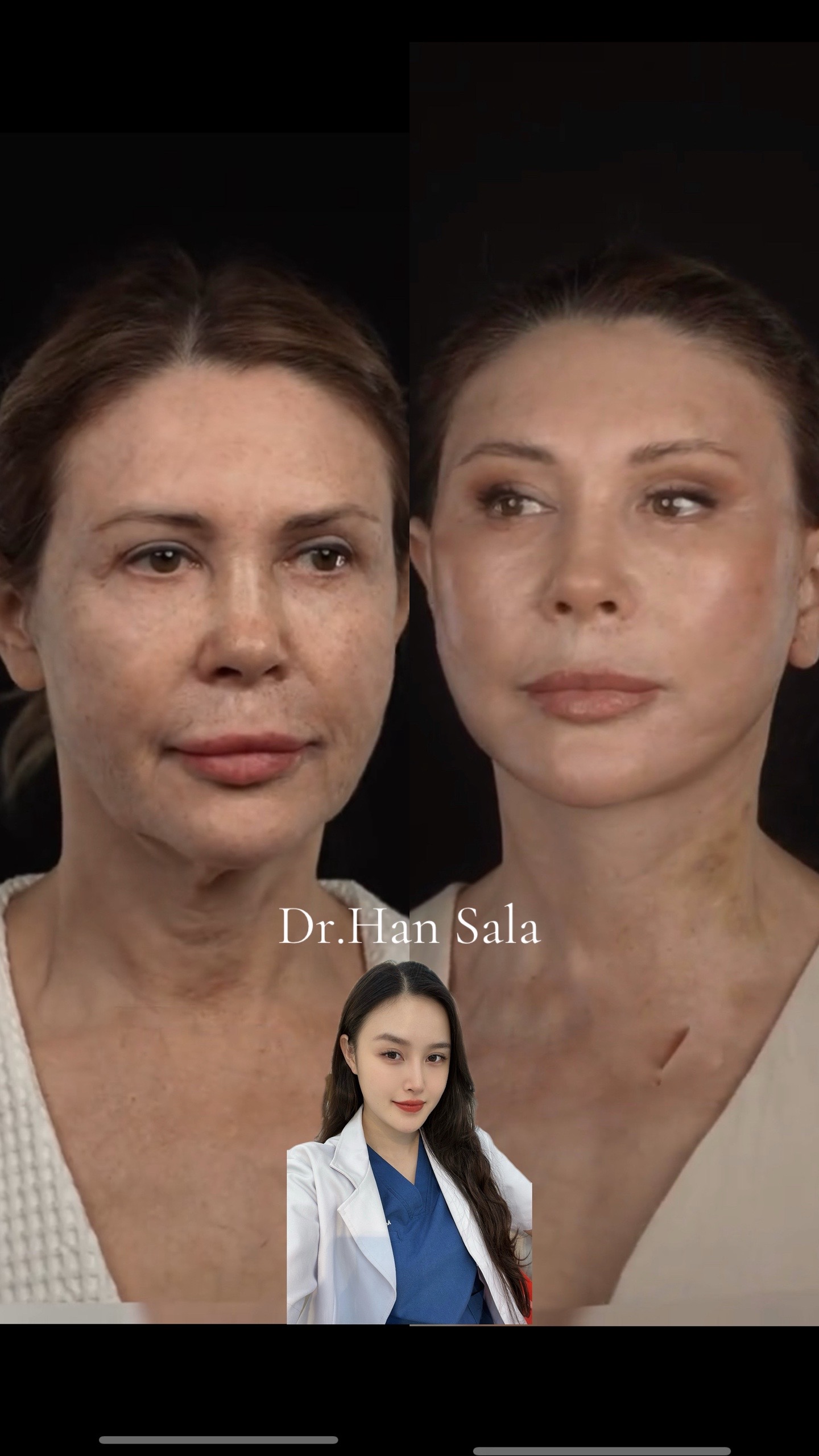 @Dr.Han Sala Beauty