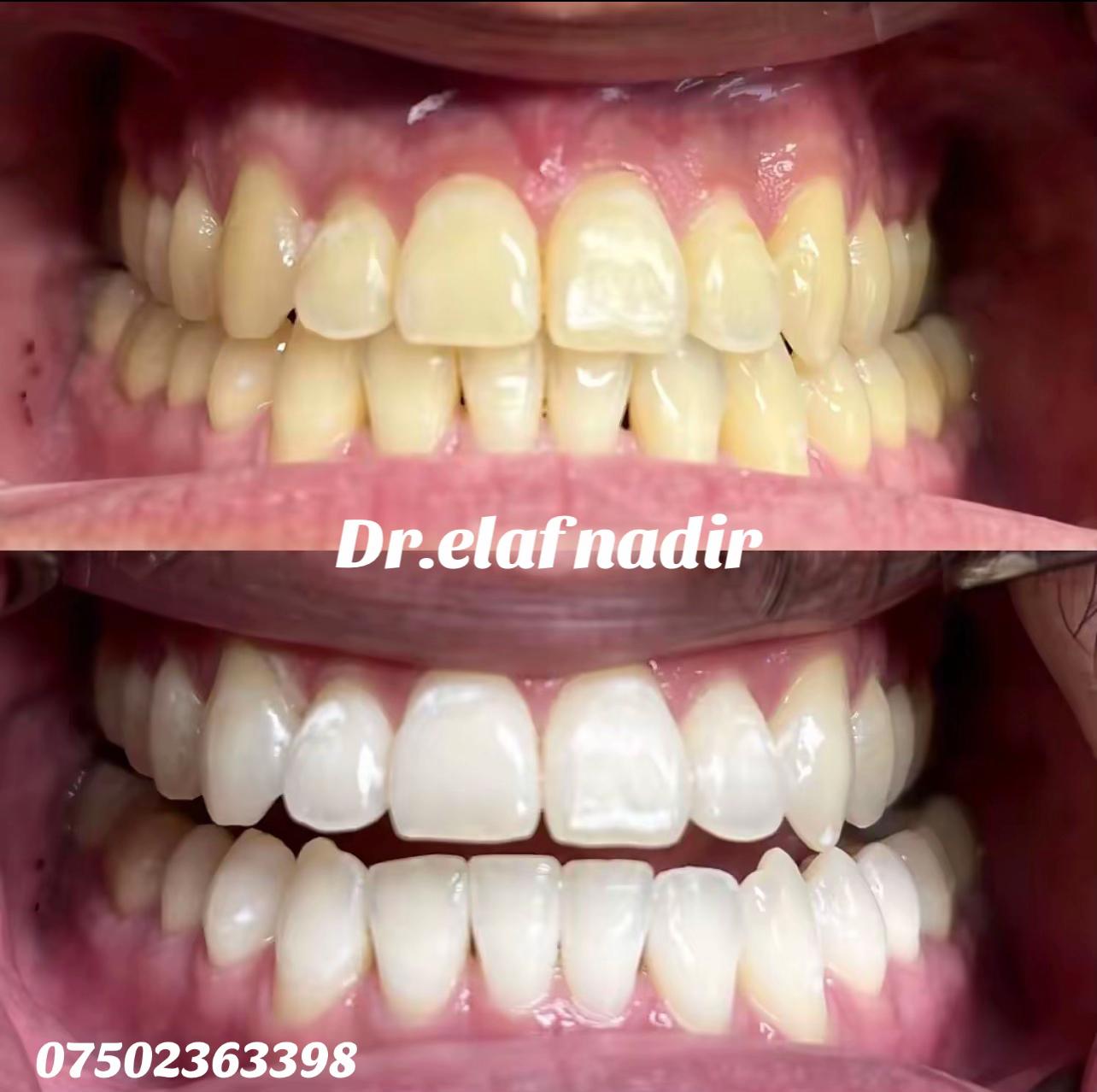 @dr.elaf.nadir