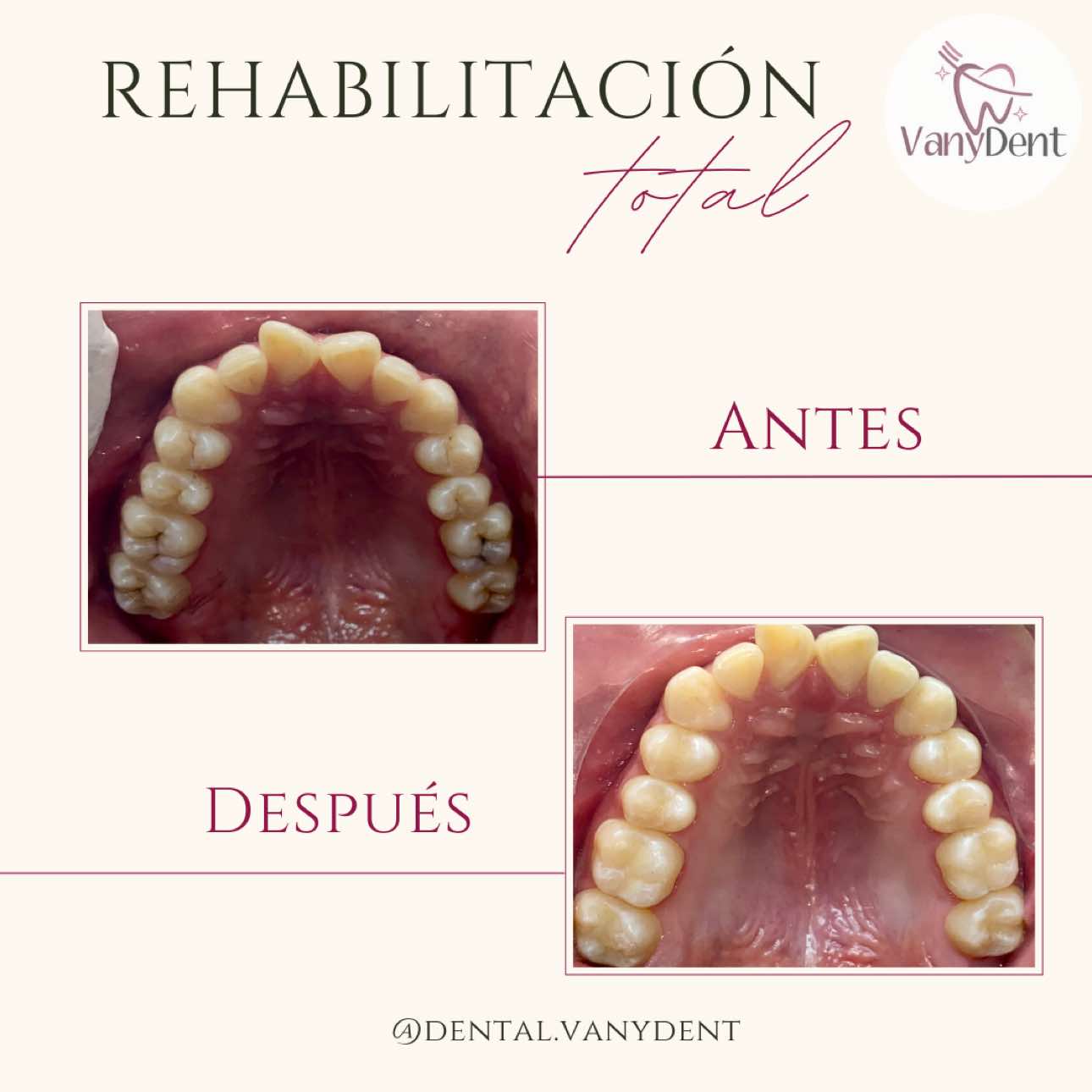@Dental Vanydent