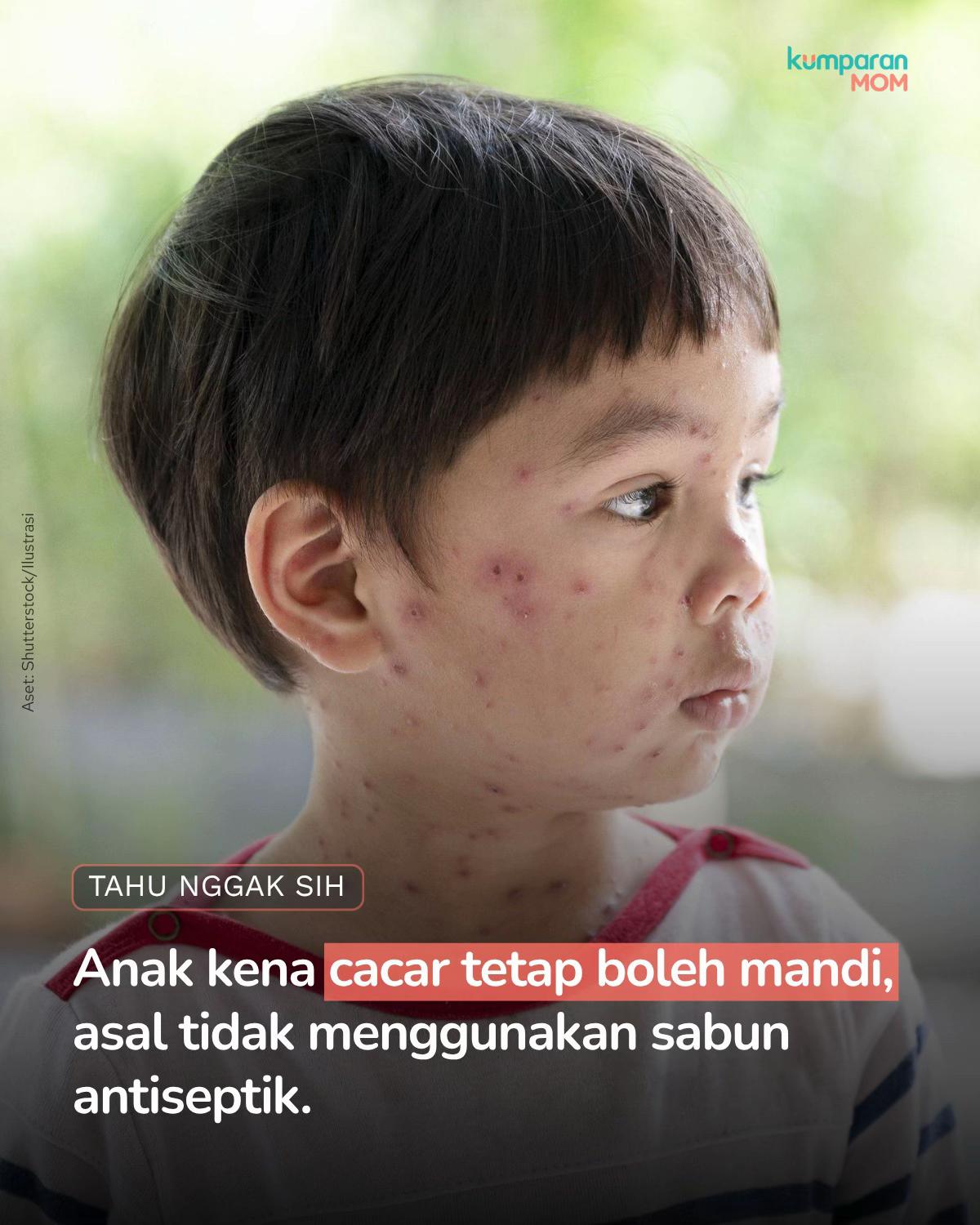 @kumparanMOM