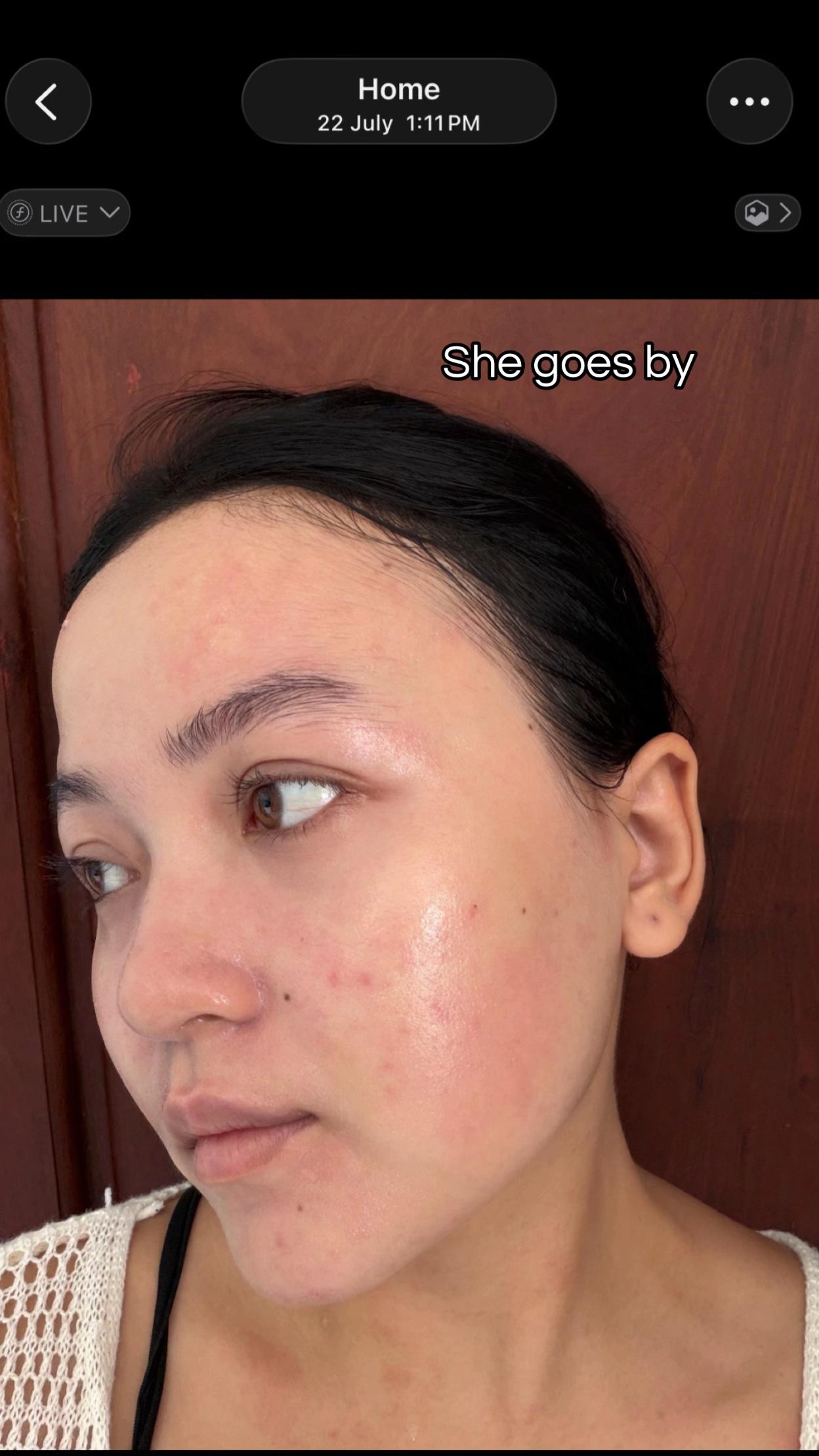 @BetterSkin