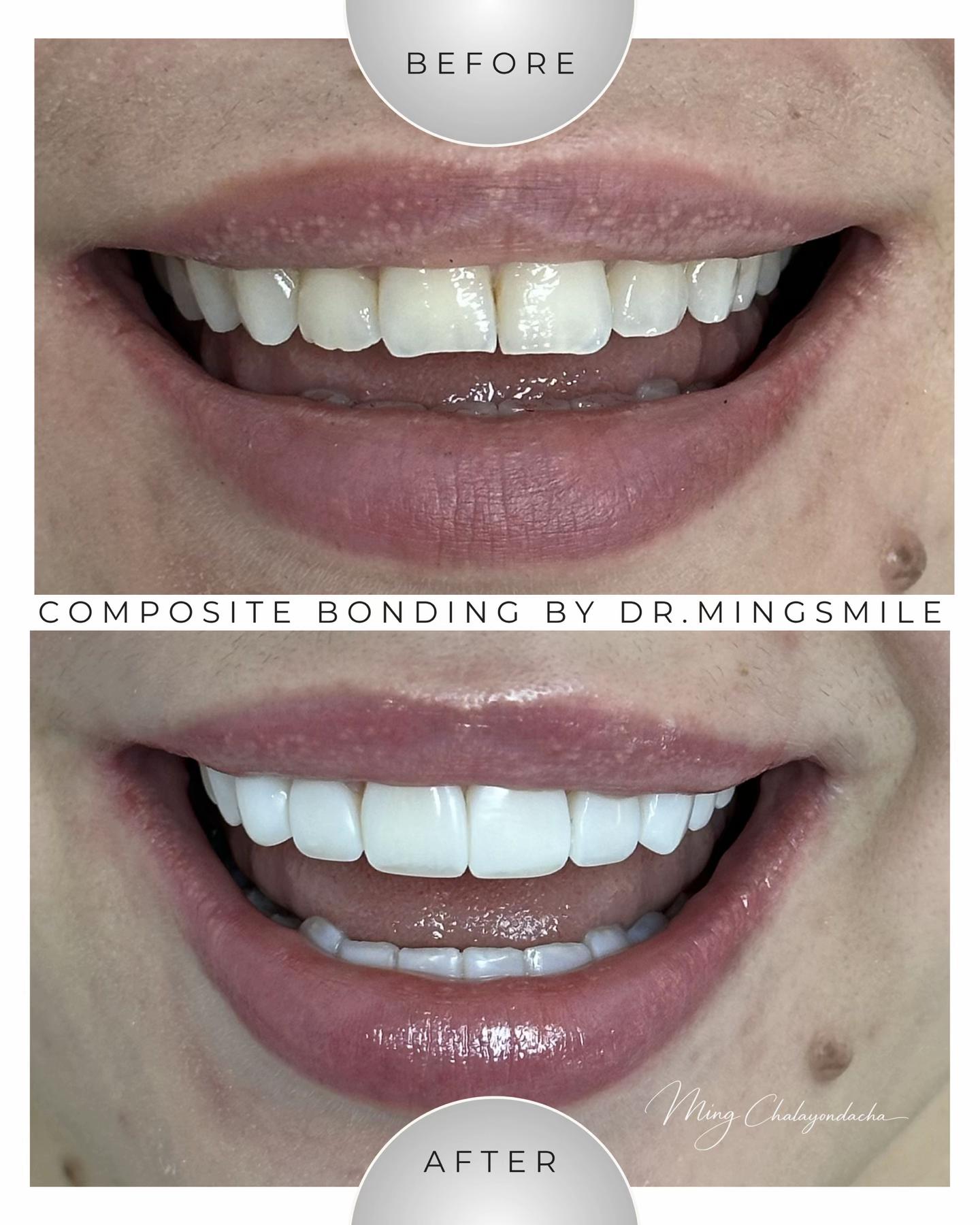 @Dr.MingSmile &hearts;️ Bangkok&Krabi